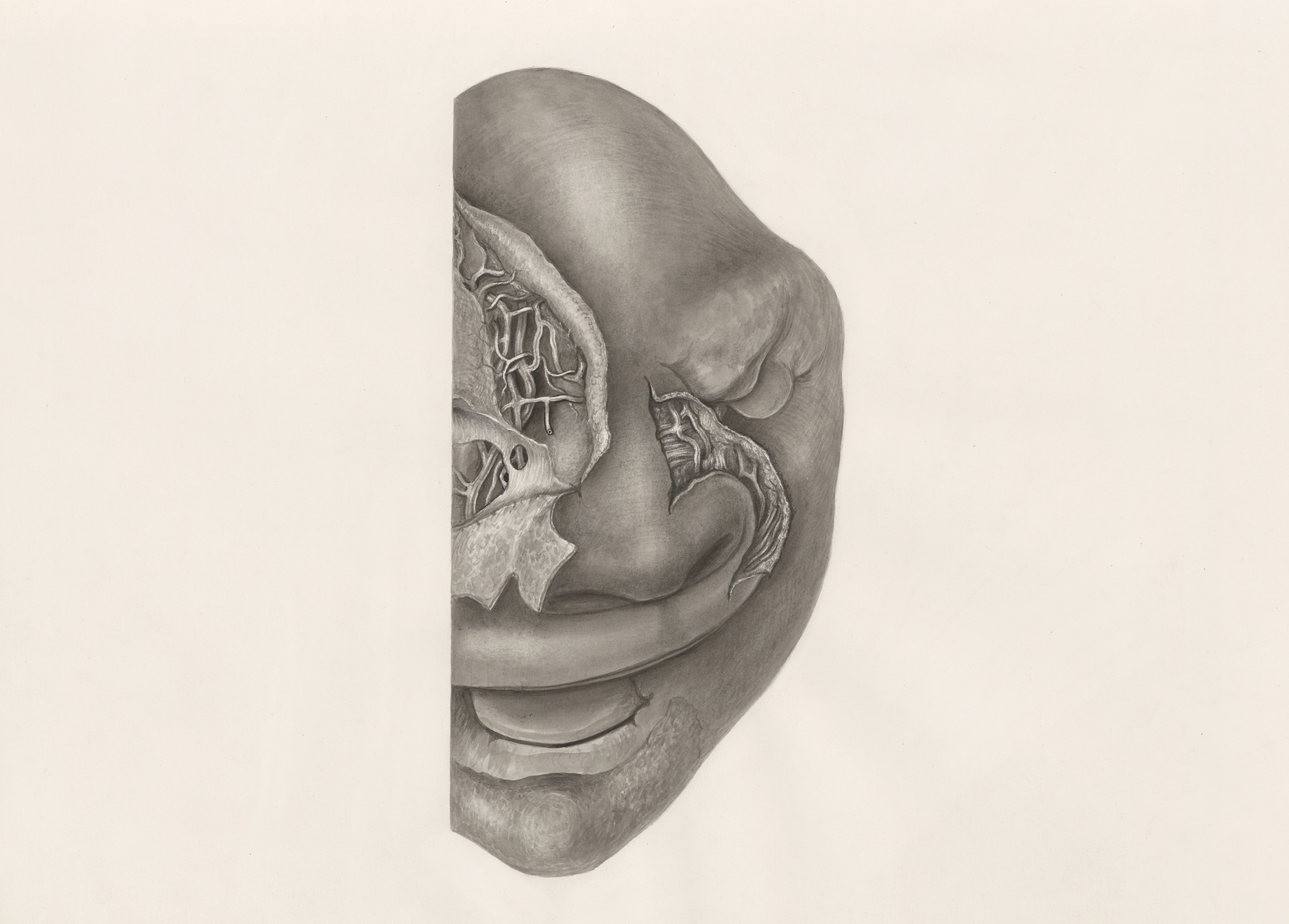 Deformed fetal head, partly seen from the front
