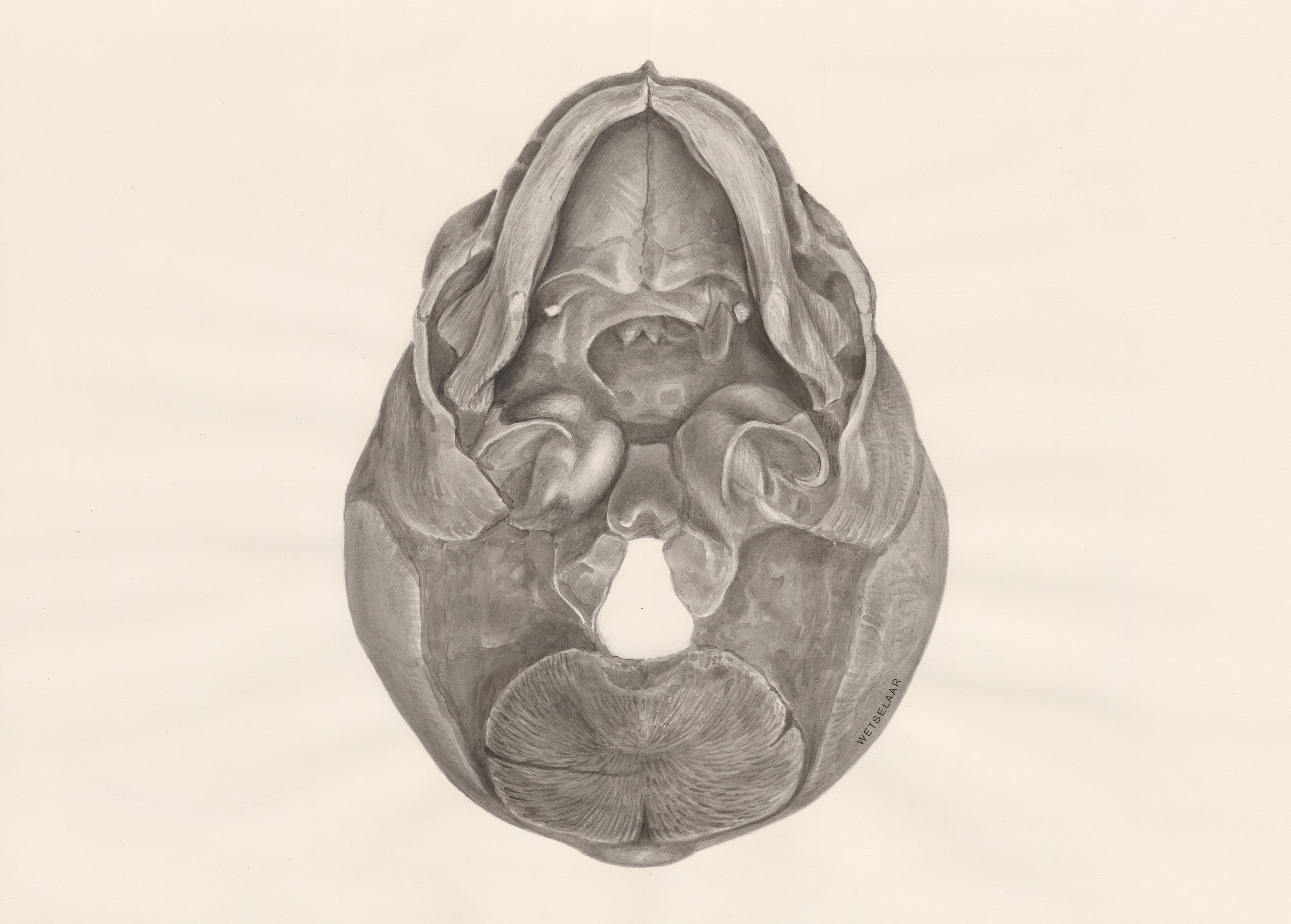 Deformed fetal skull, seen from below