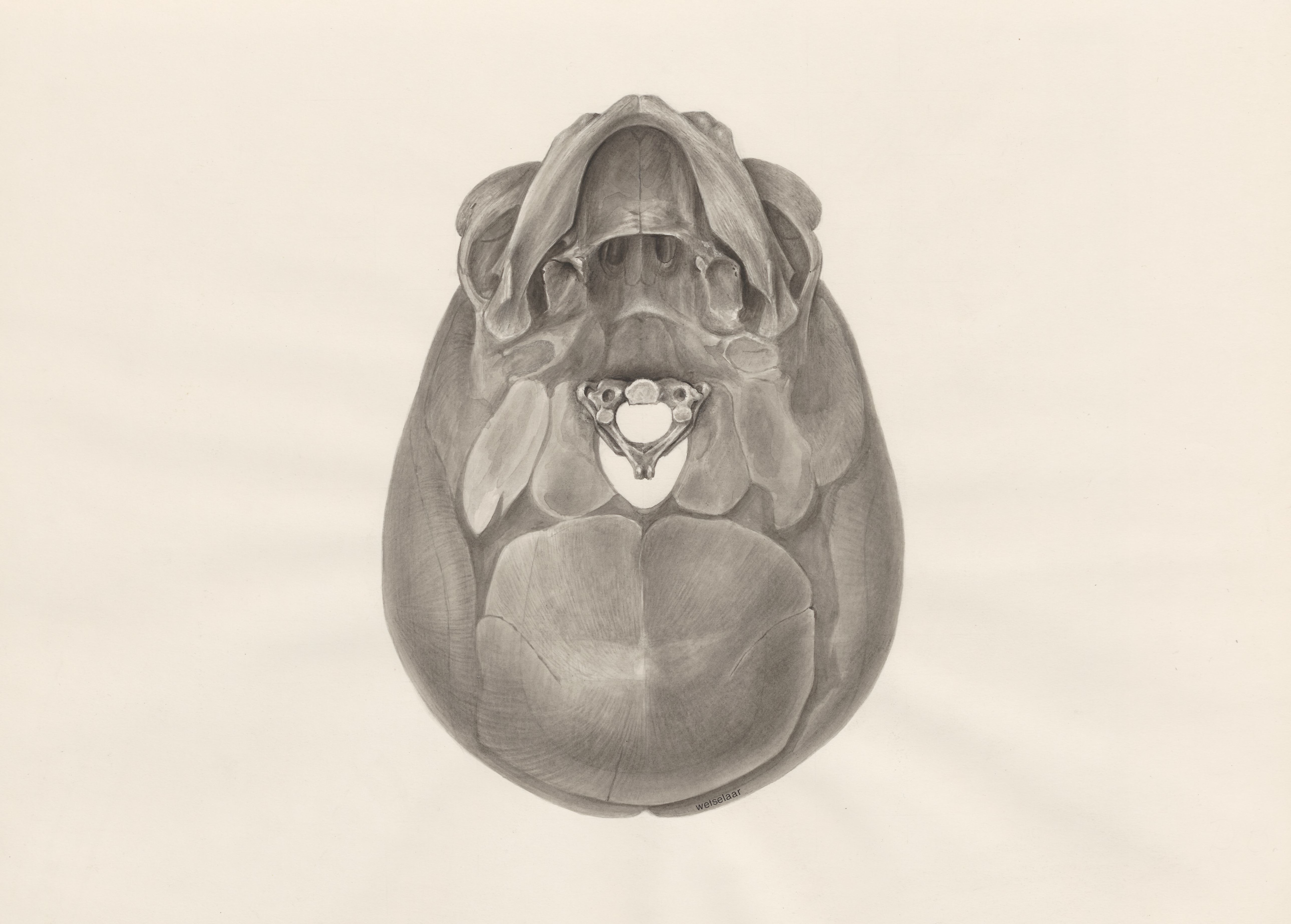 Deformed fetal skull, seen from below