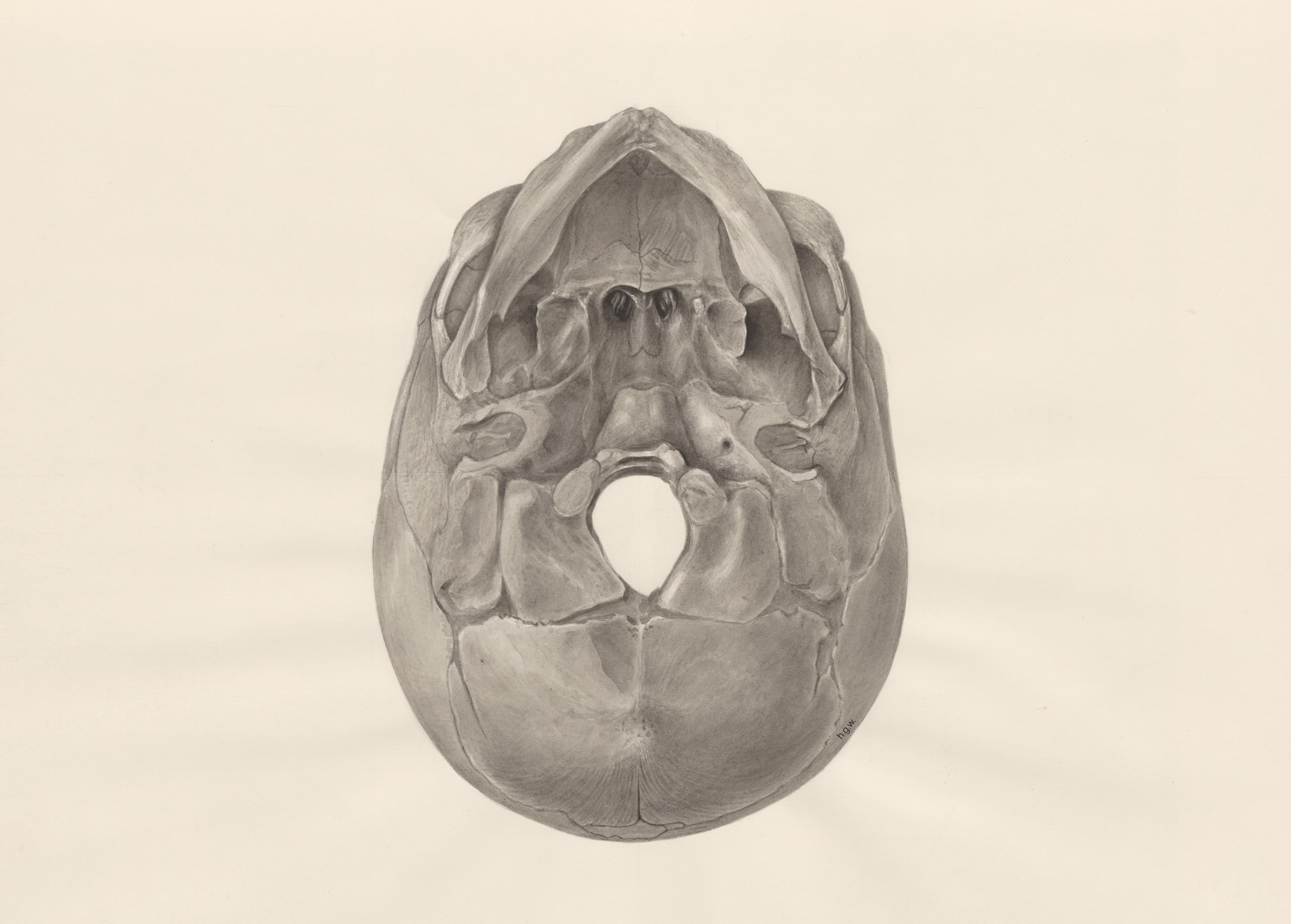 Deformed fetal skull, seen from below