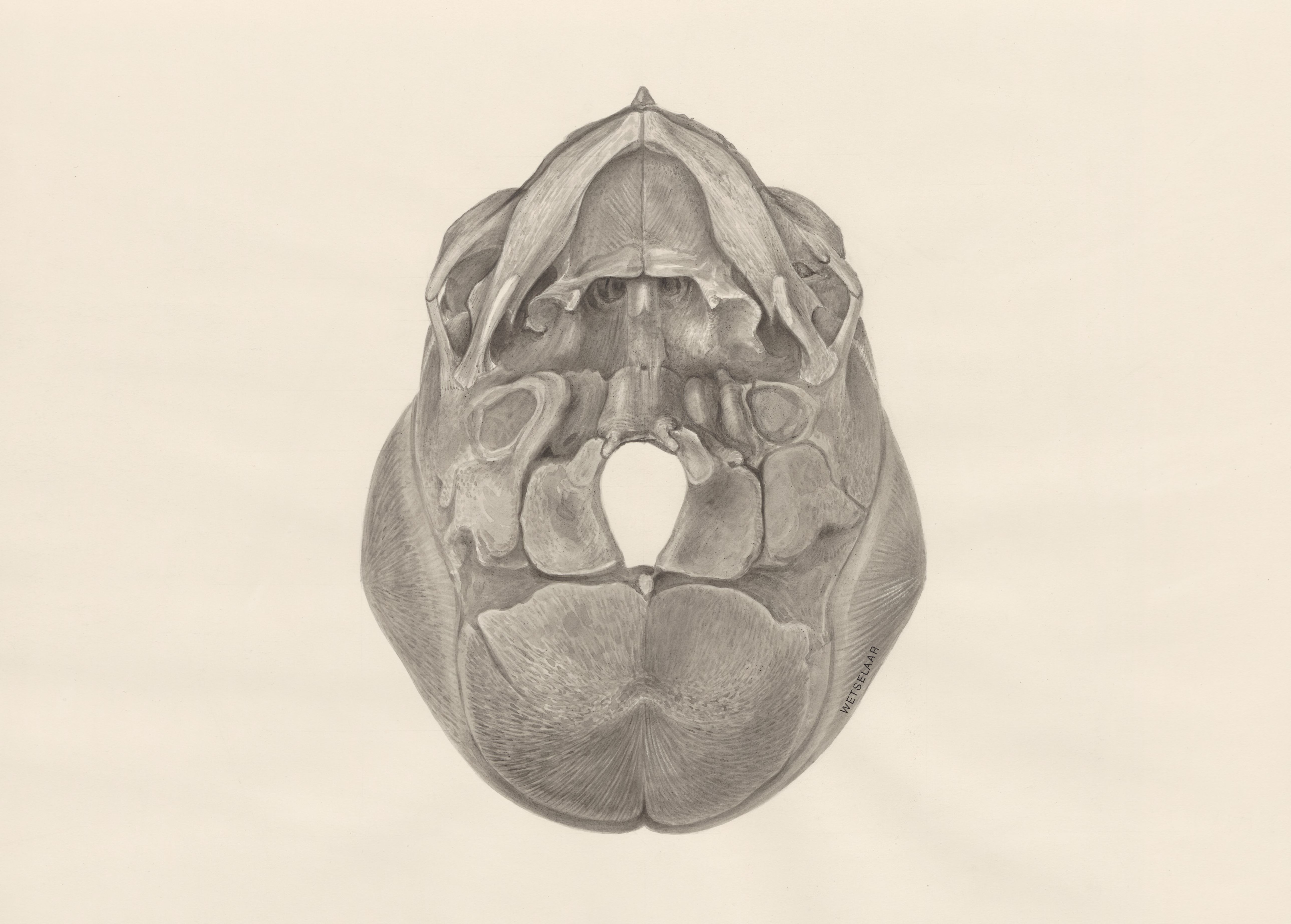 Deformed fetal skull, seen from below