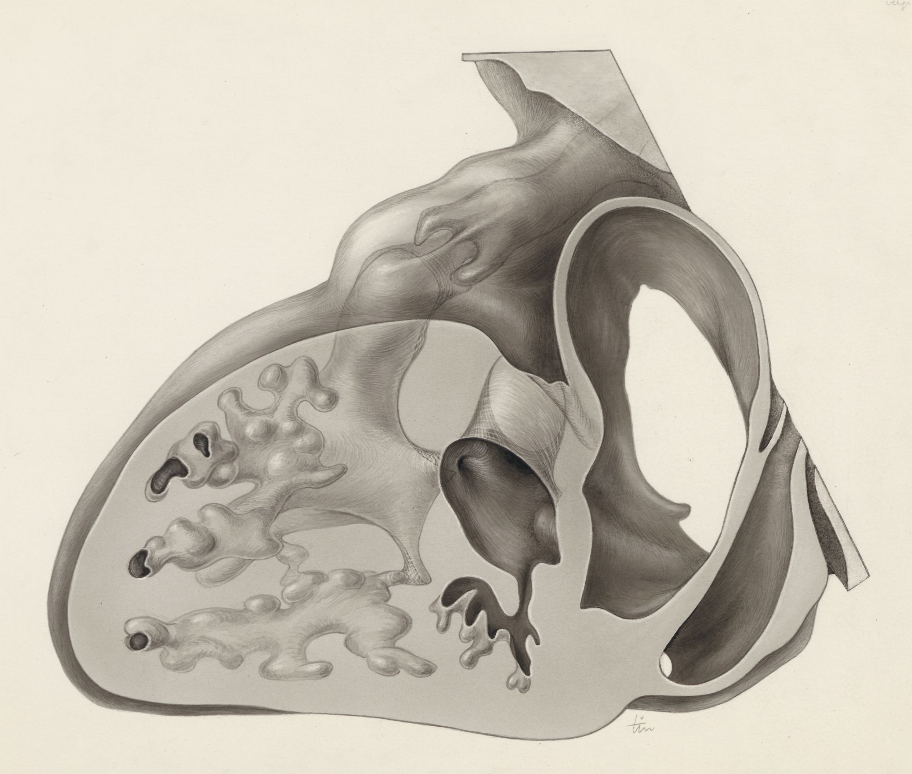 Embryonic heart
