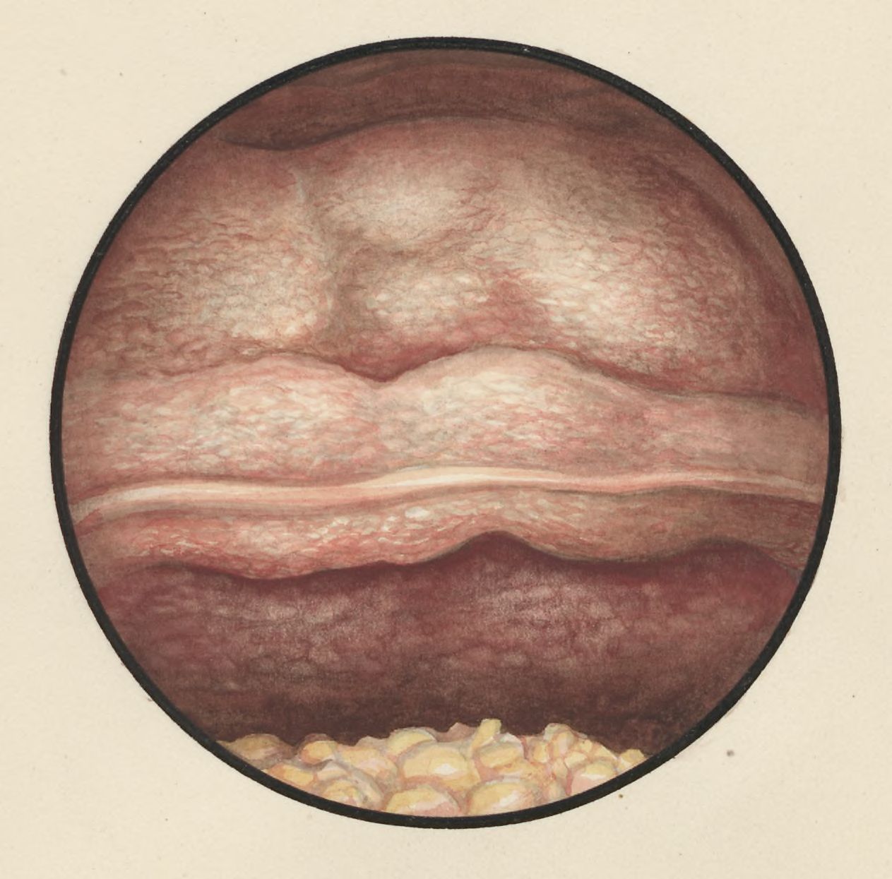 Microscopic magnification of the abdomen
