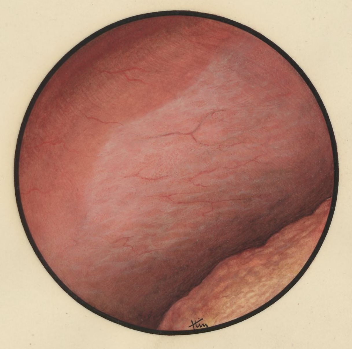 Microscopic magnification of the abdomen