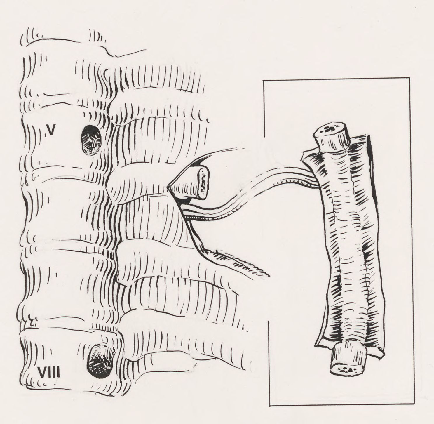 Orthopedic surgery