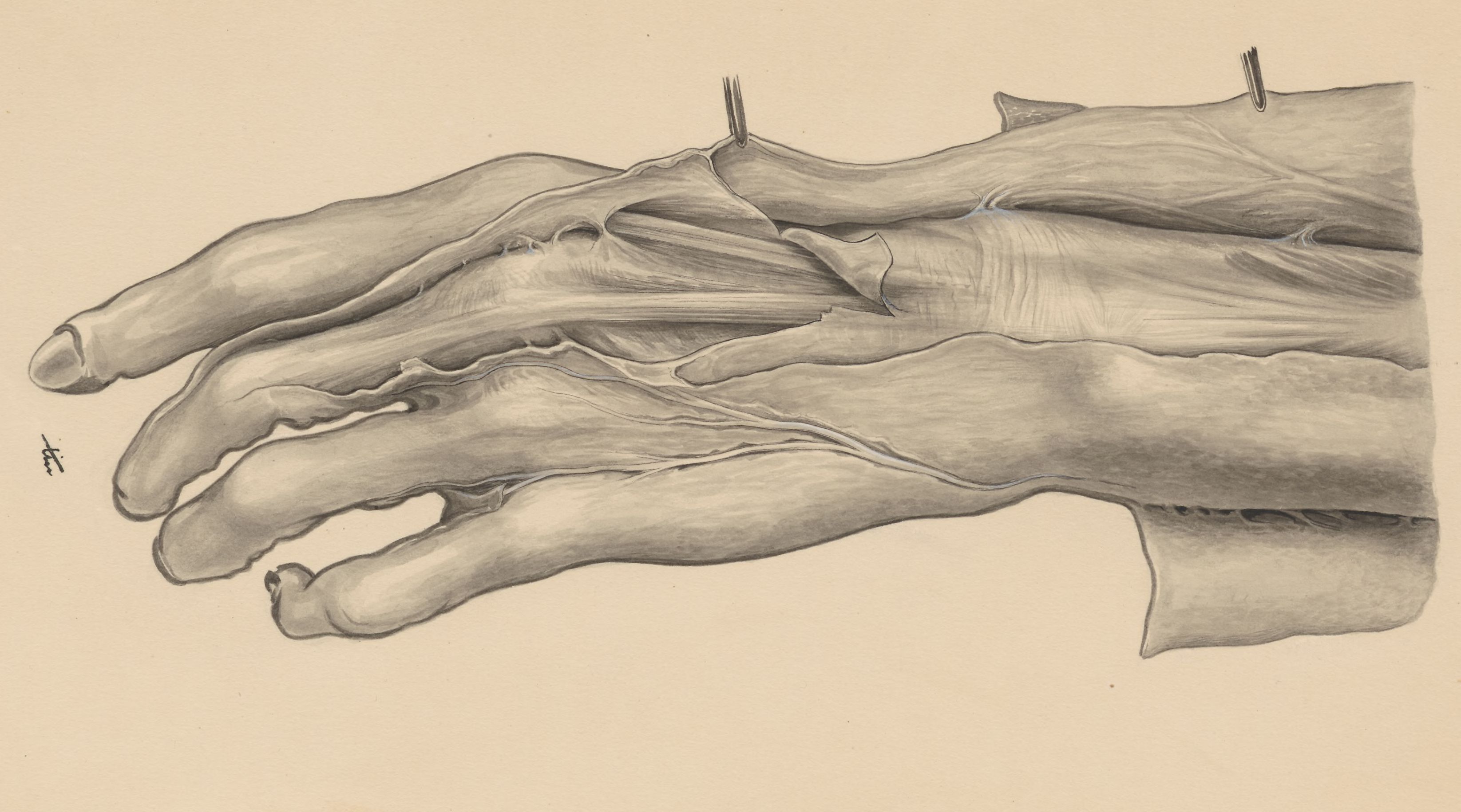 Muscular tissue of the hand