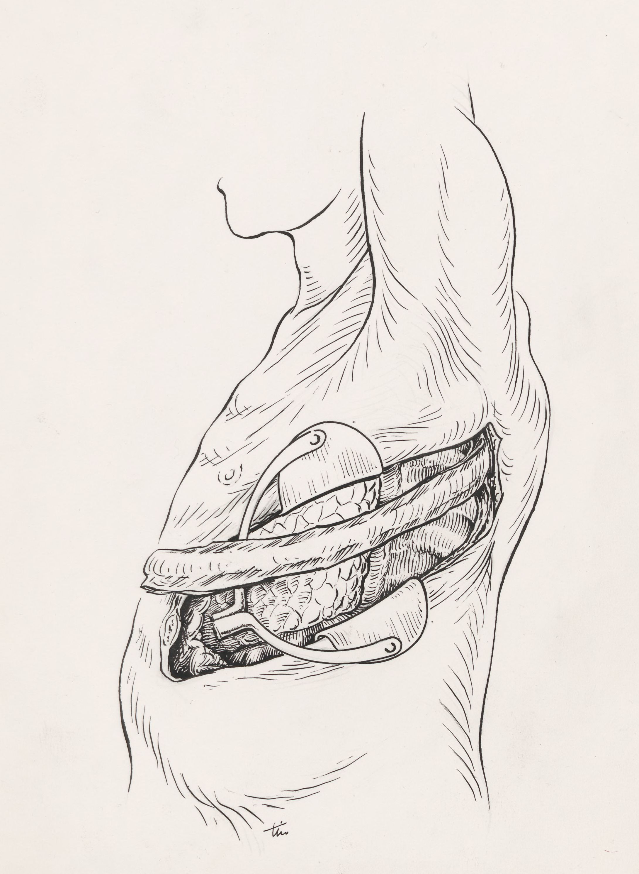 Orthopedic surgery