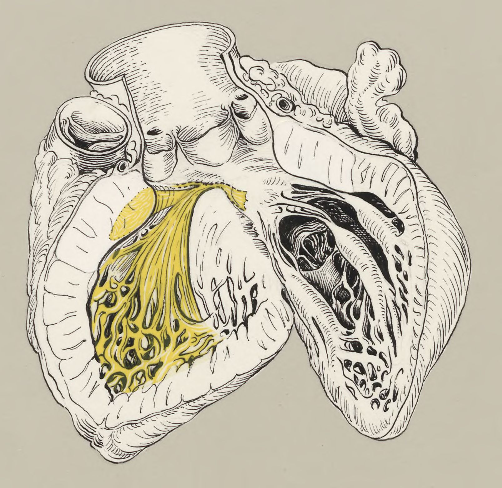 Heart