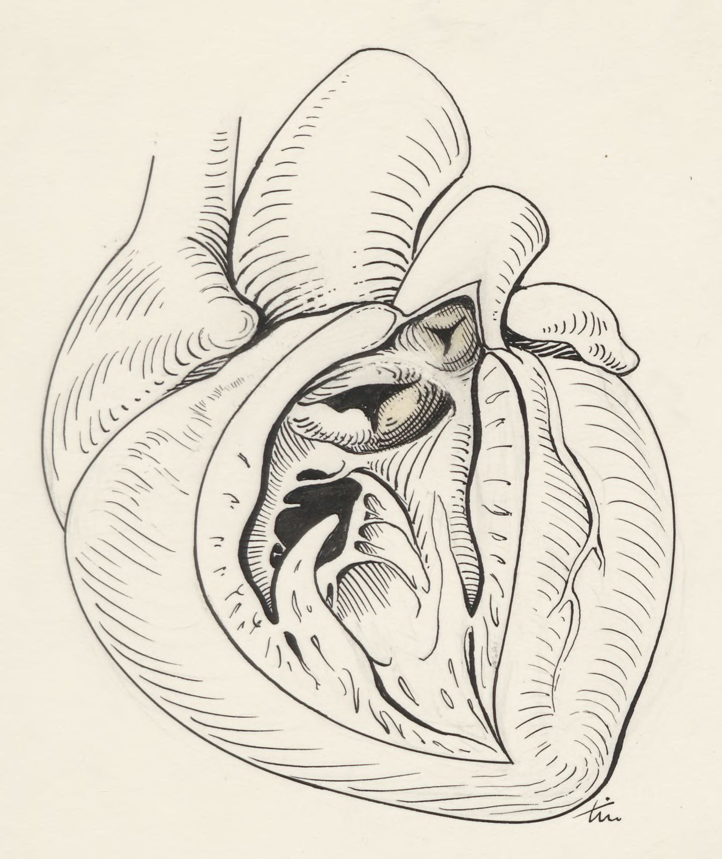 Heart