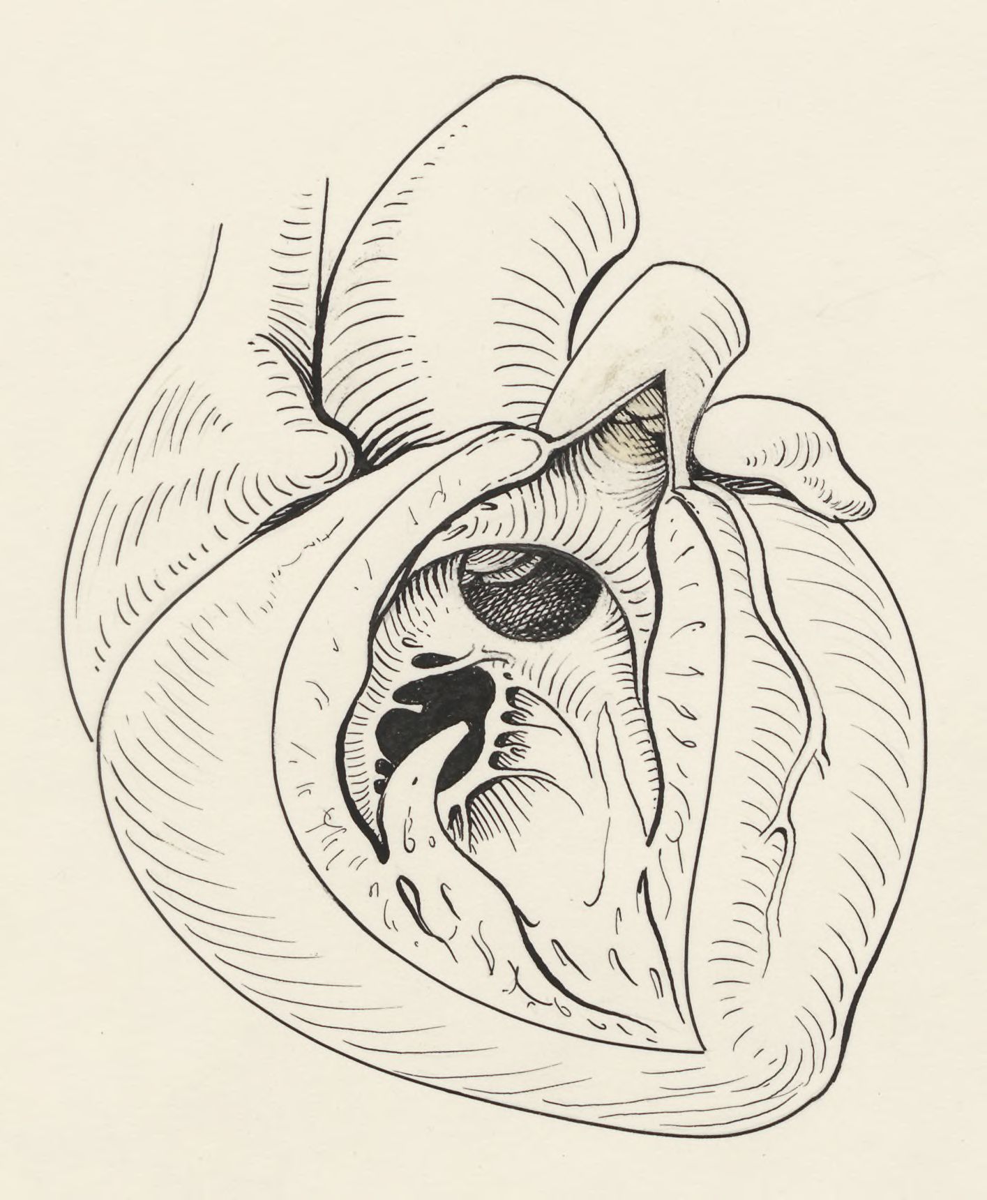 Heart