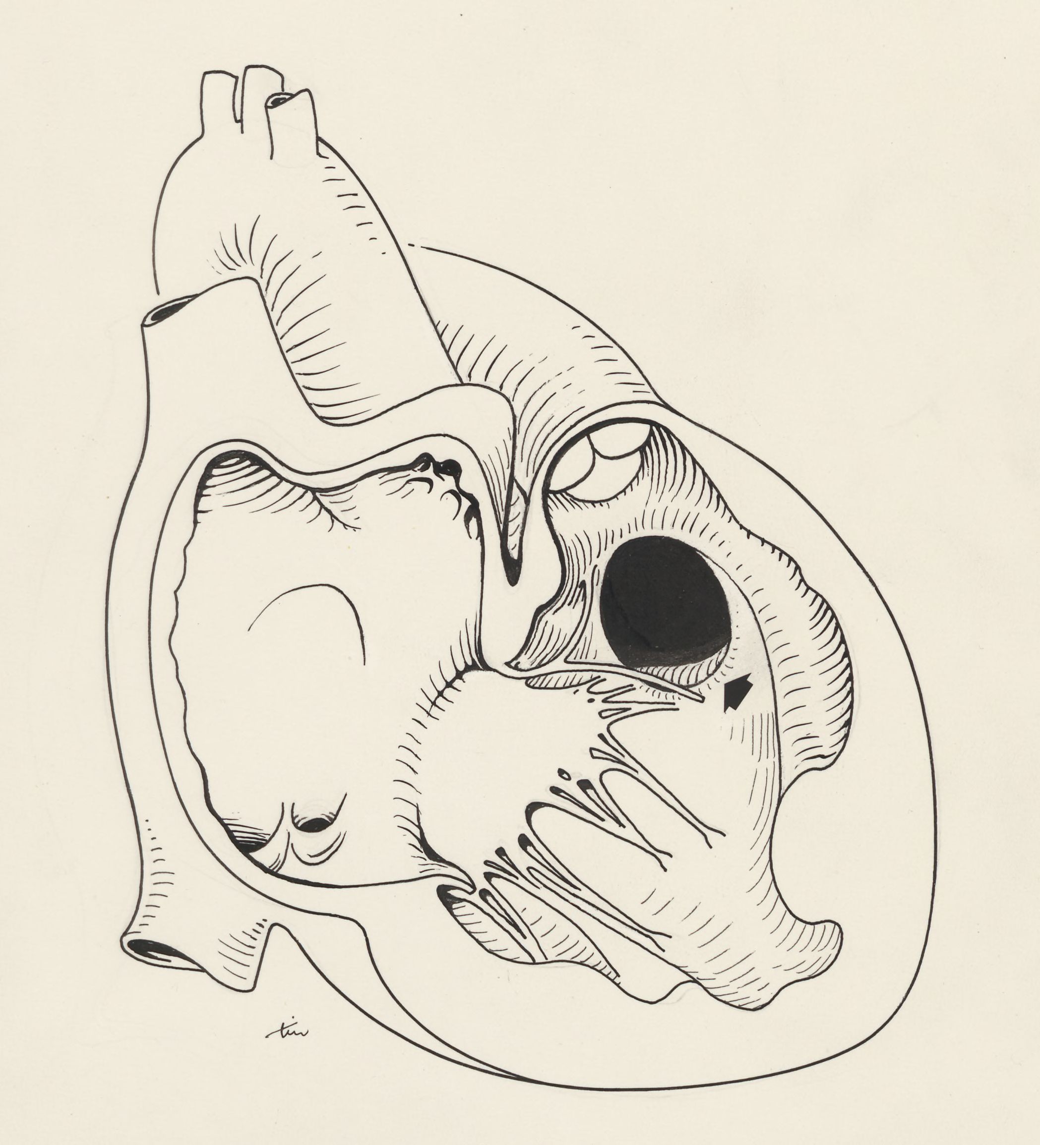 Heart