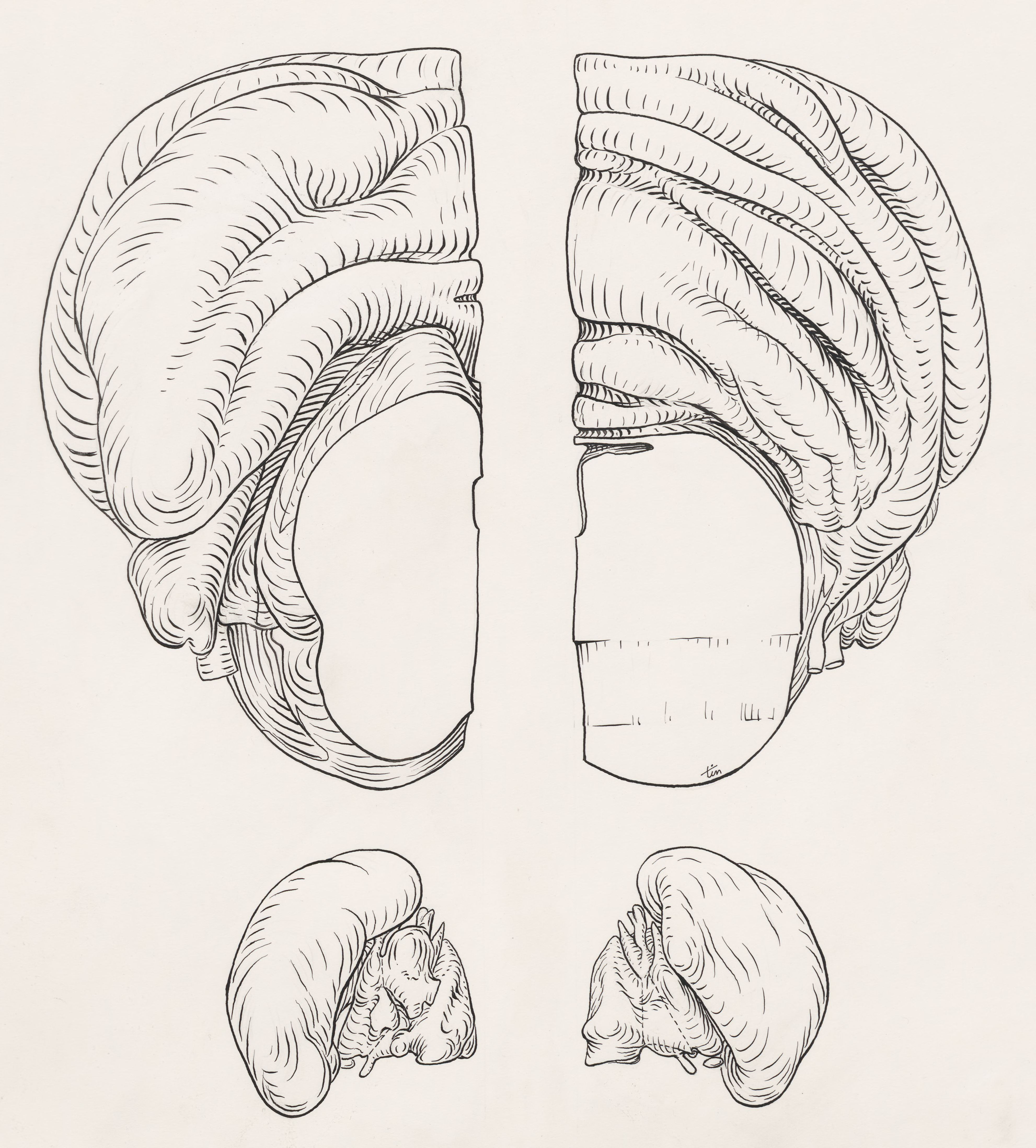 Reconstruction of the cerebellum