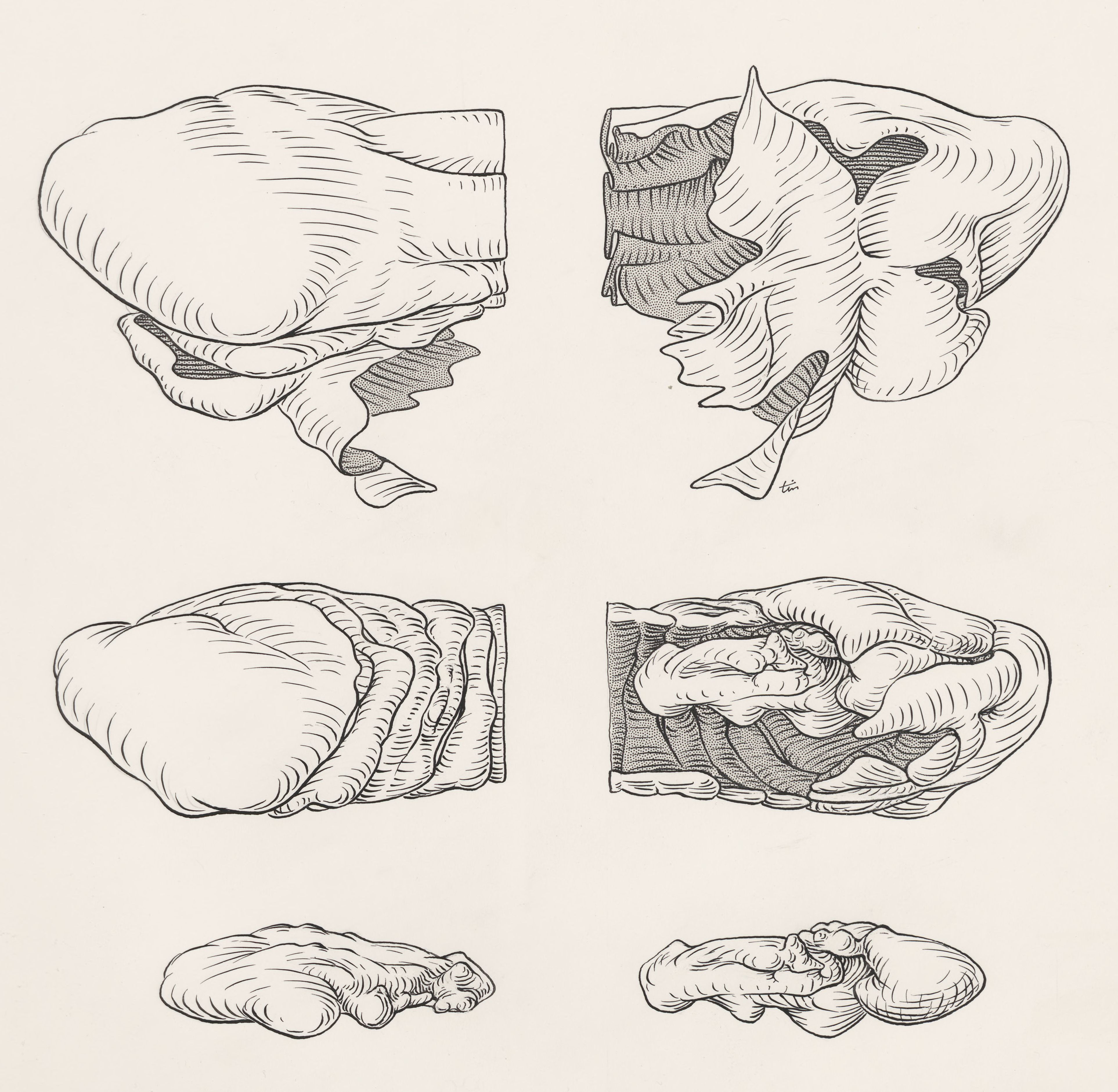 Reconstruction of the cerebellum