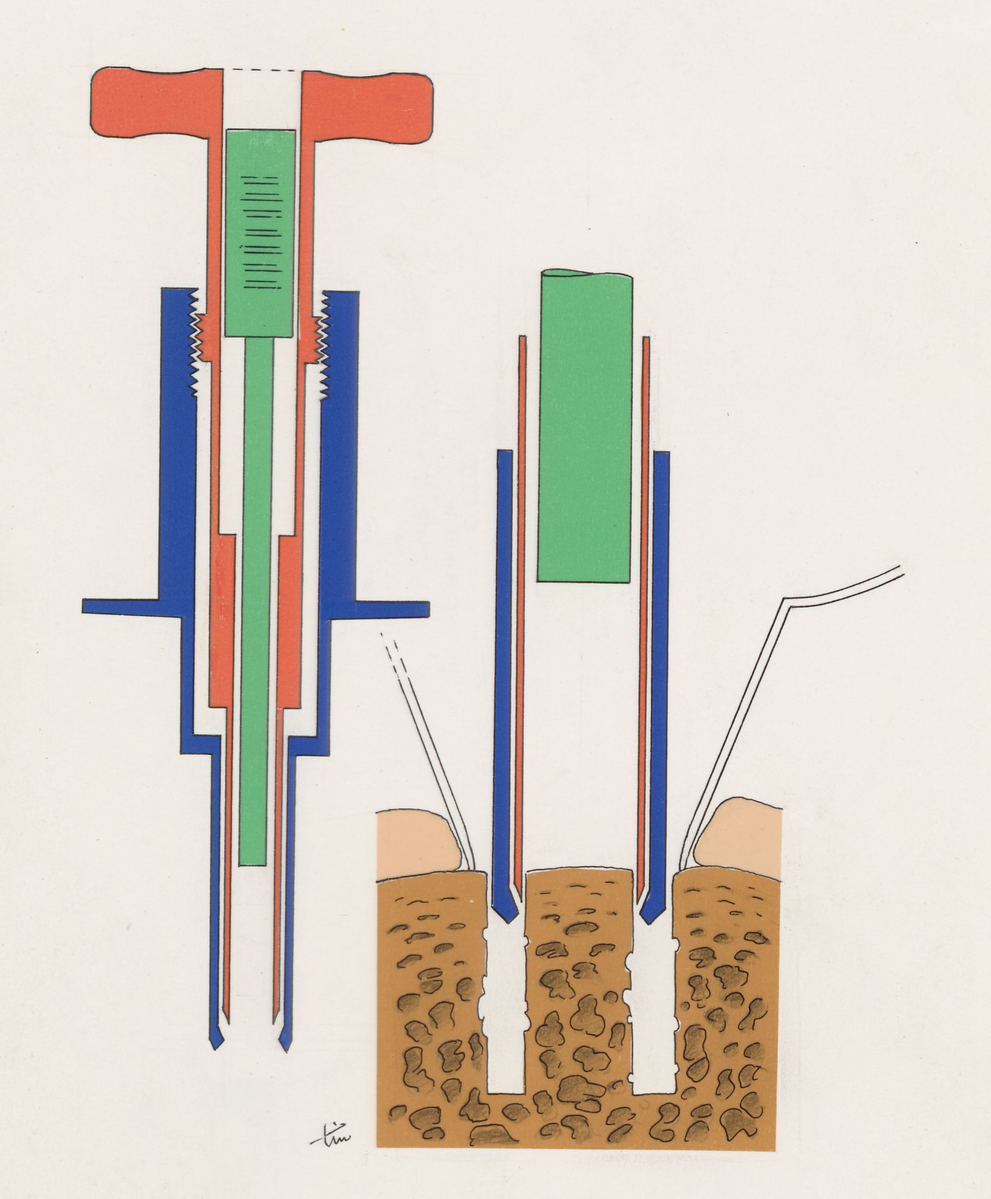 Bone drilling technique