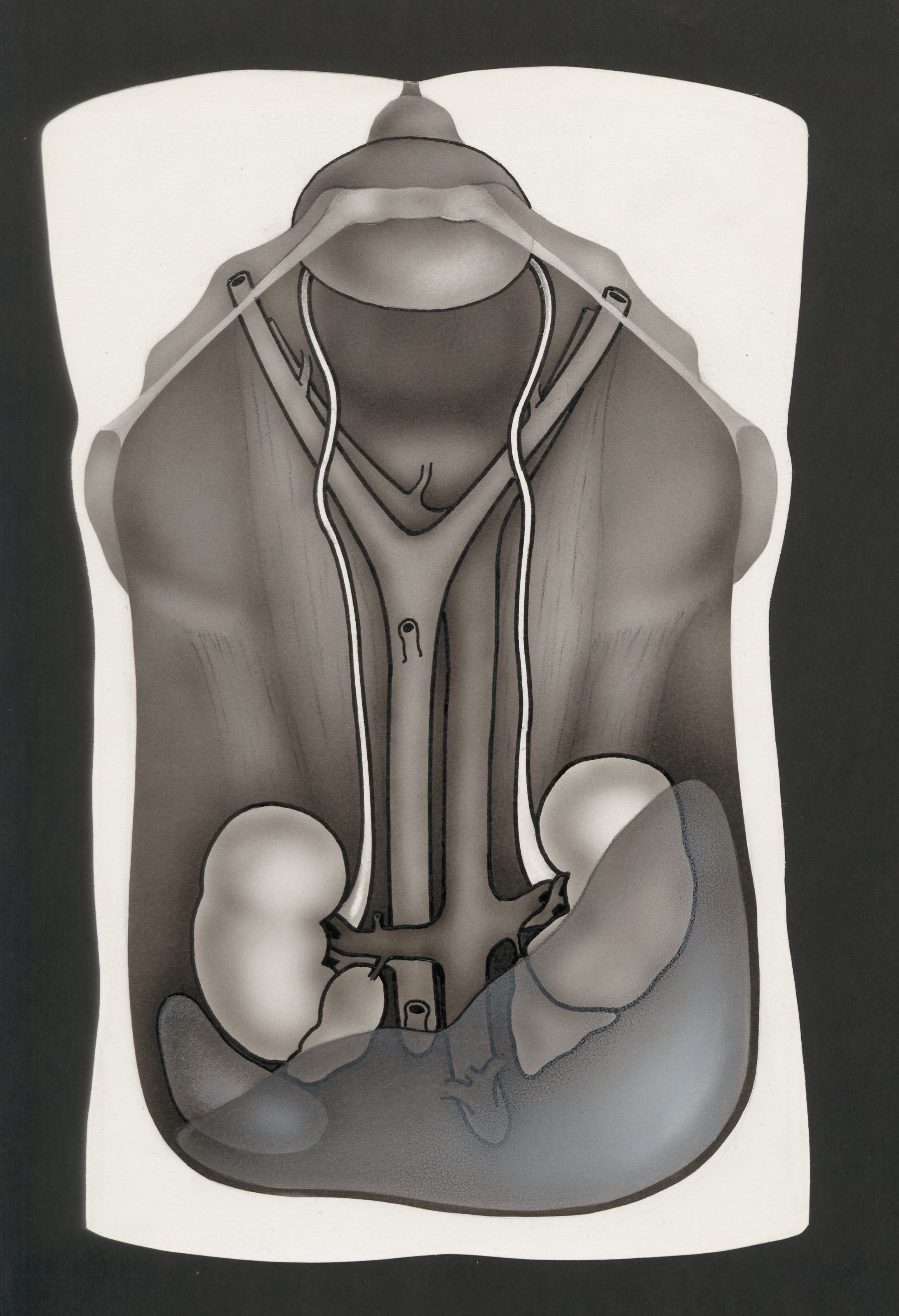Opened abdominal cavity, with the kidneys