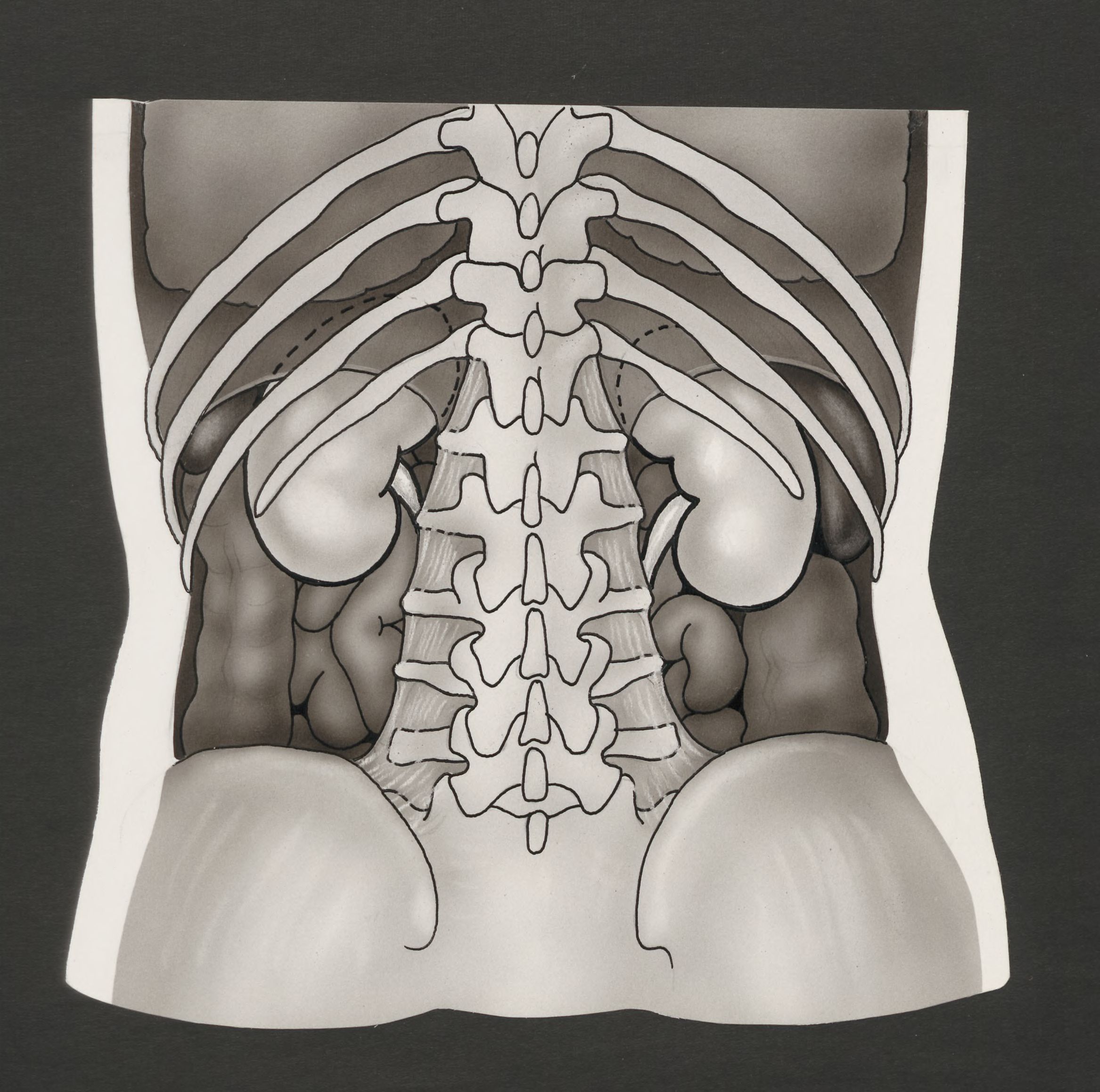 Kidneys seen through the ribcage and spine