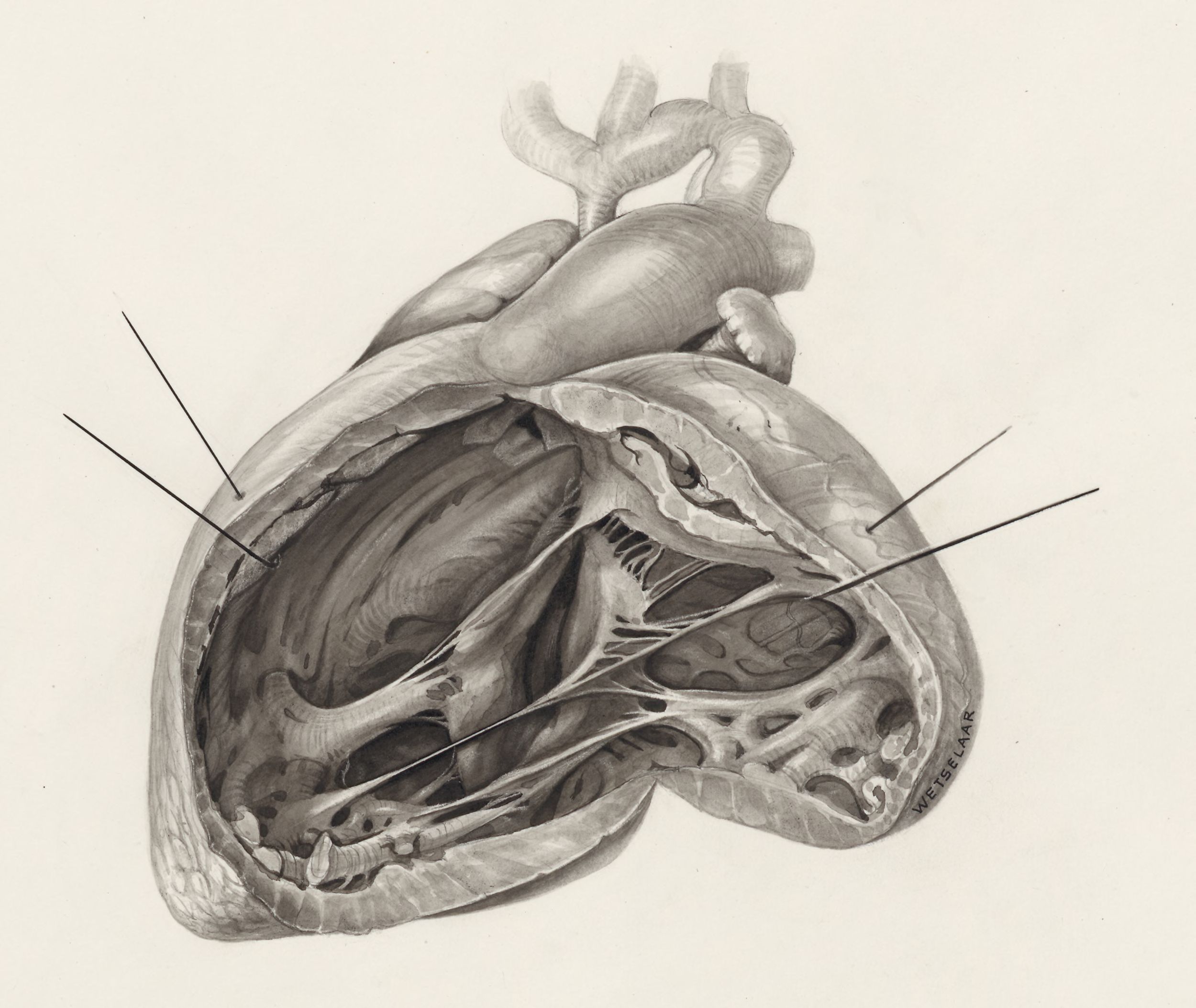 Heart