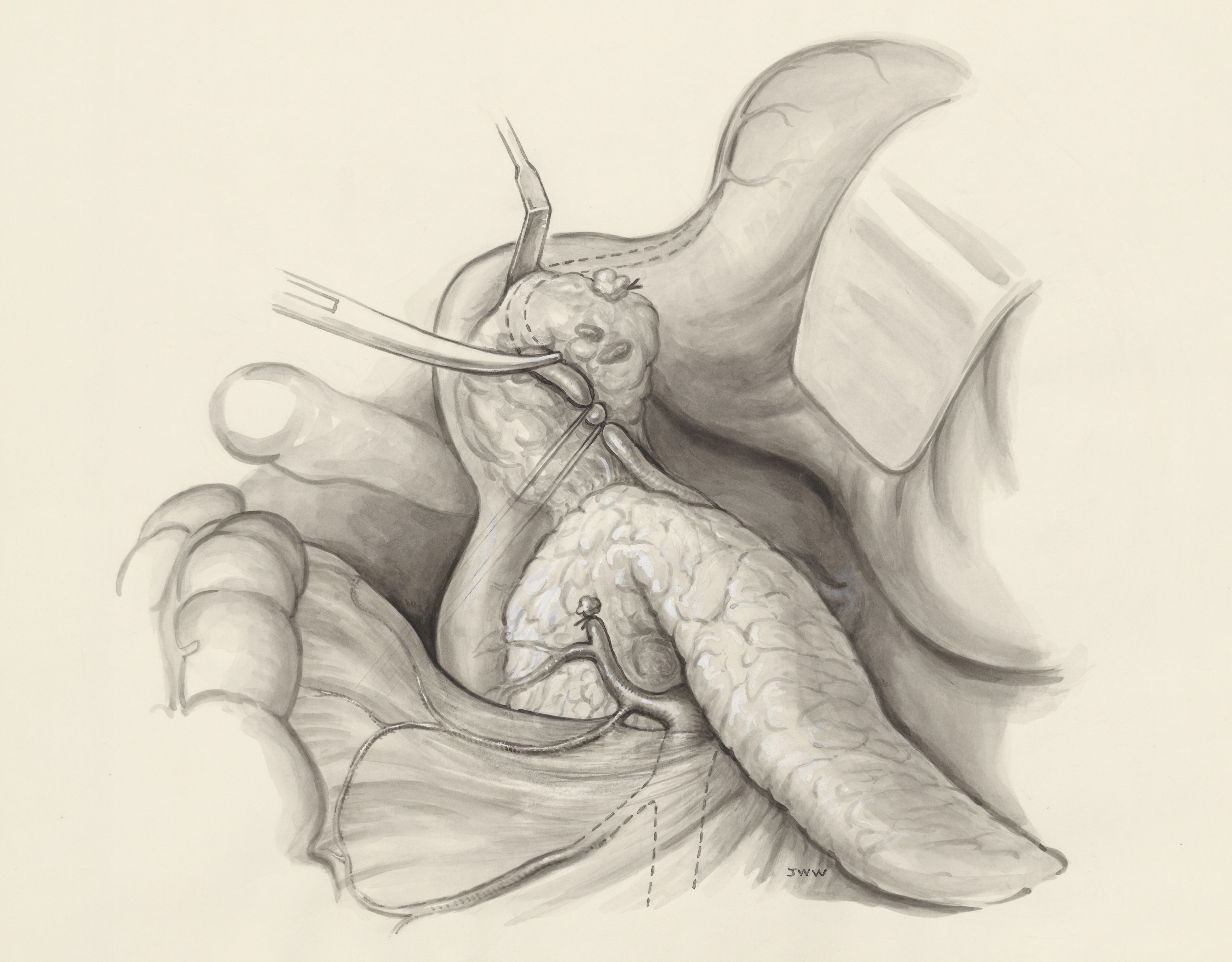Part of the human body, opened with medical clamps
