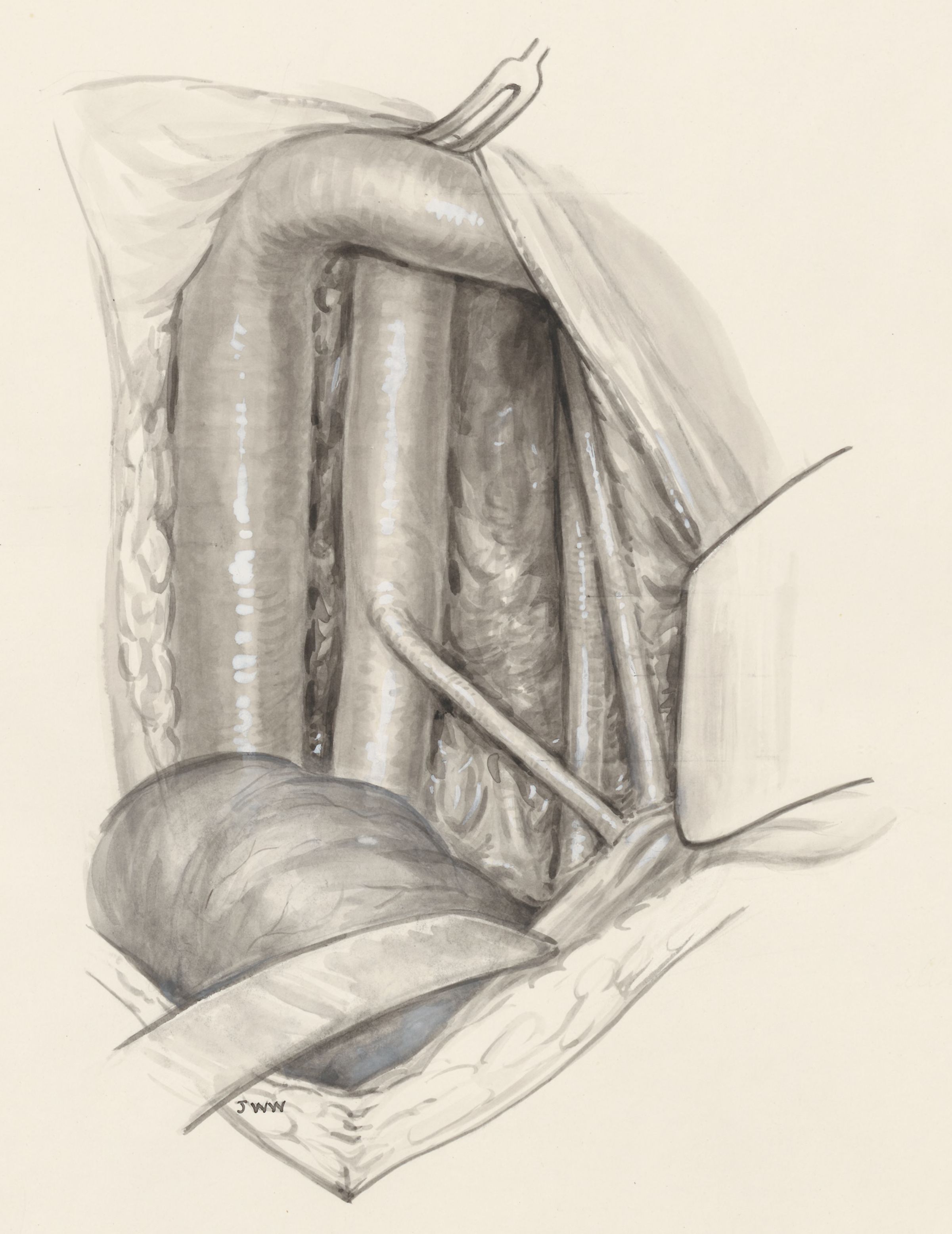 Part of the human body, opened with medical clamps