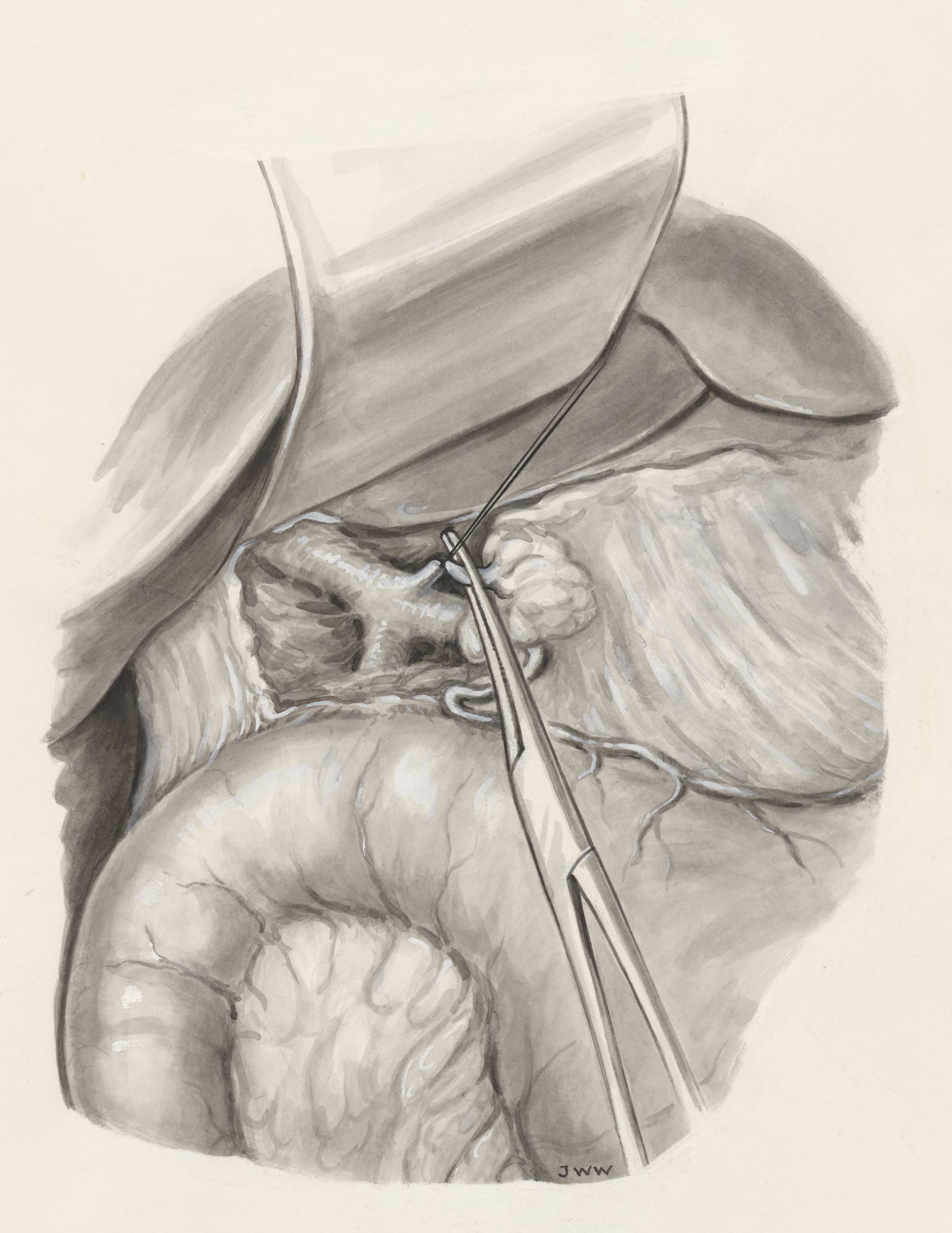 Part of the human body, opened with medical clamps