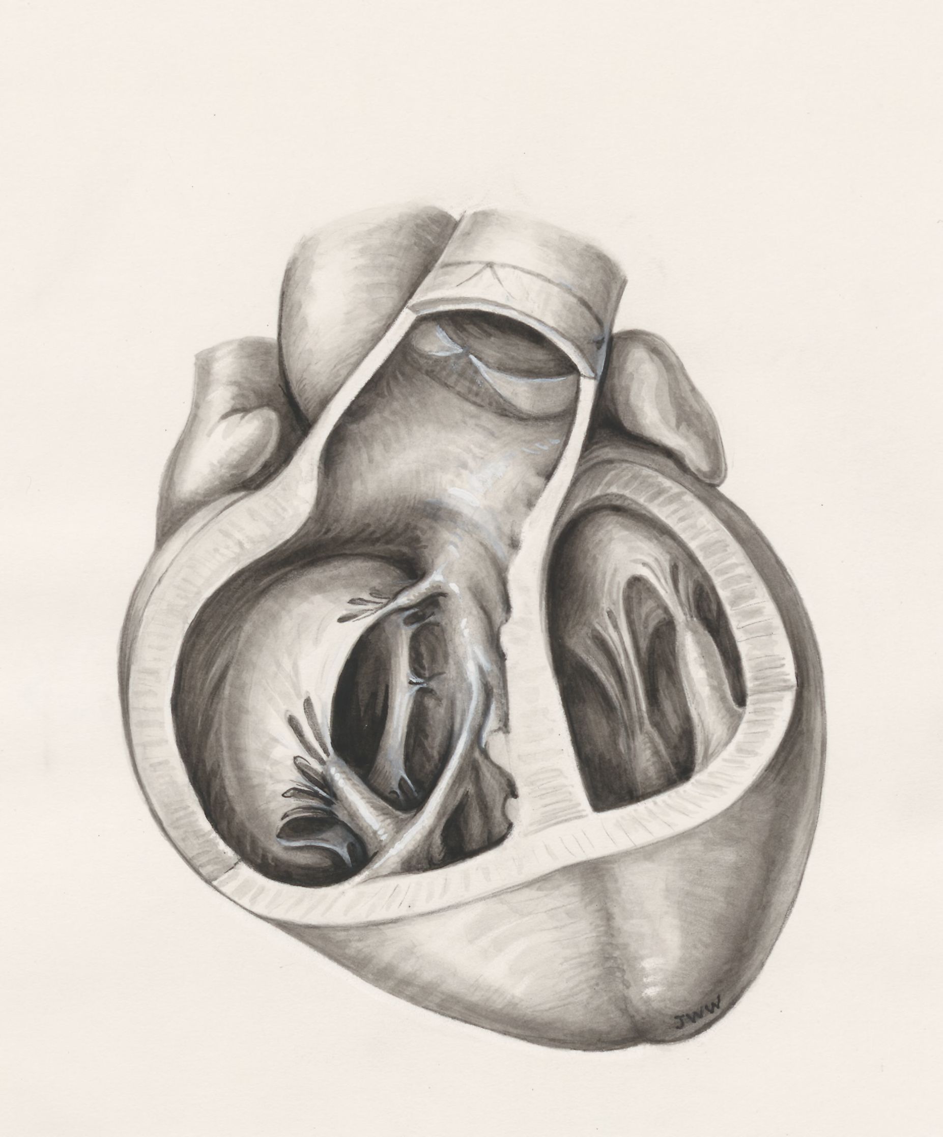 Dissect human heart
