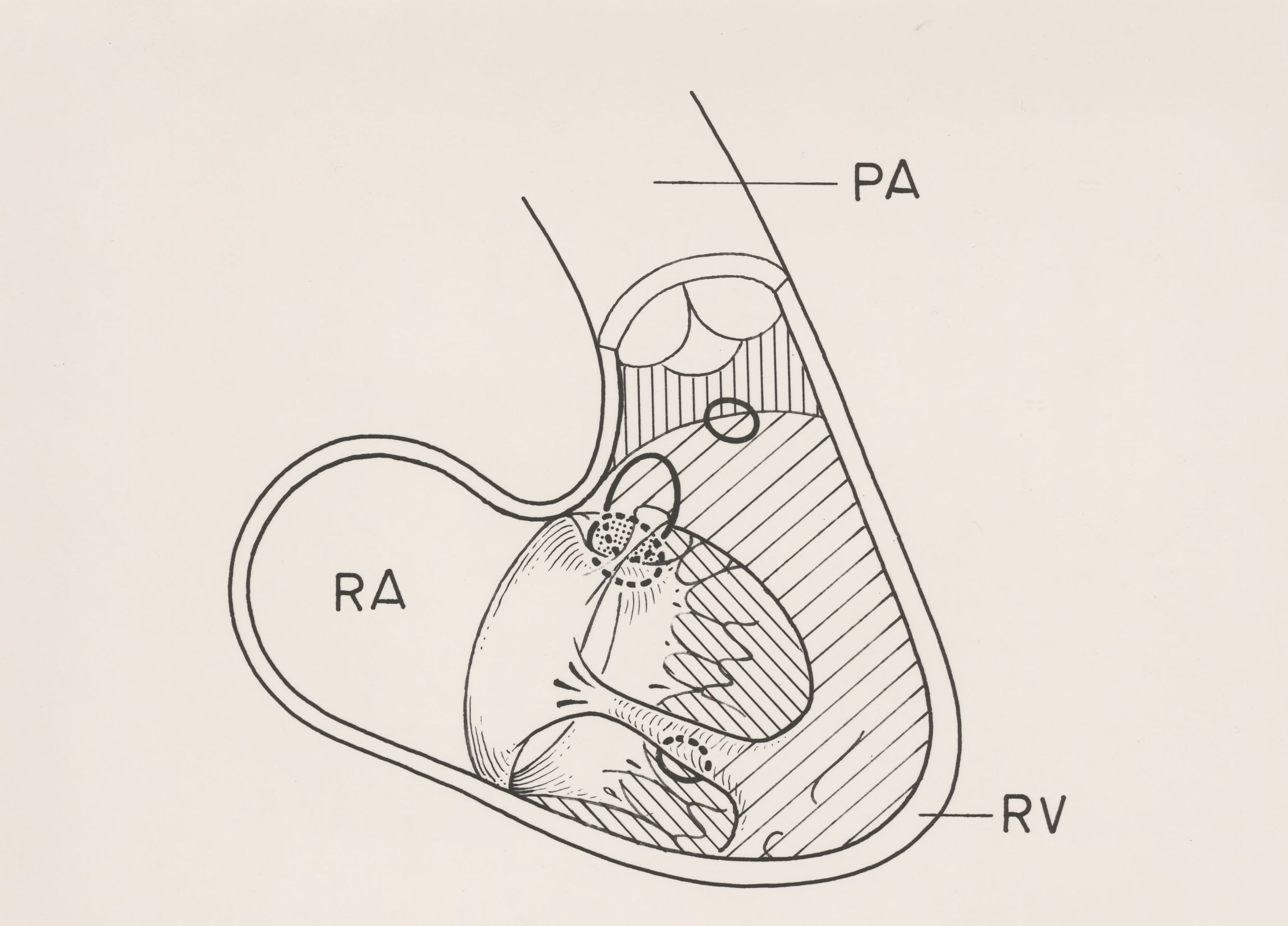 Cardiovascular system