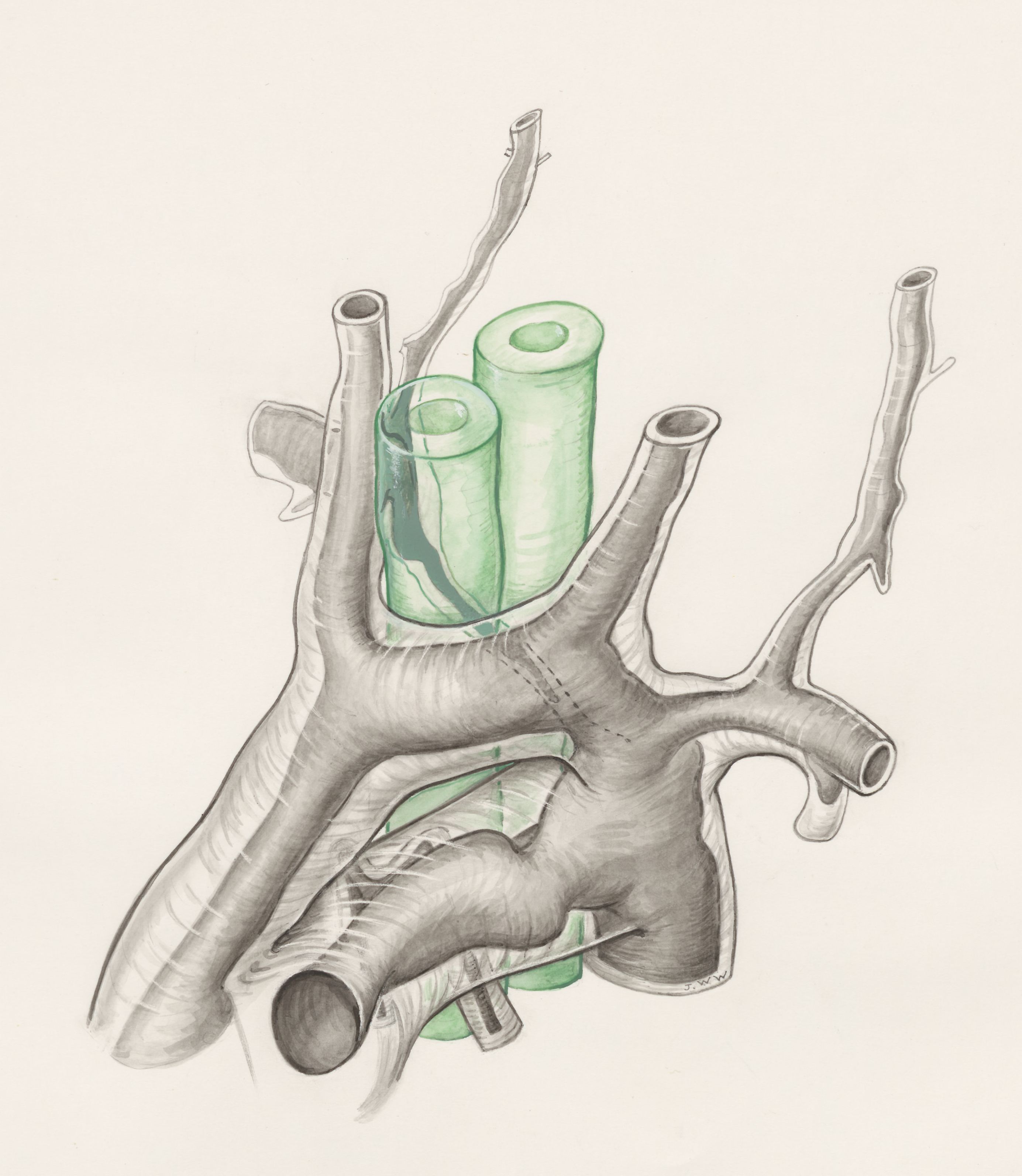 Rat embryo