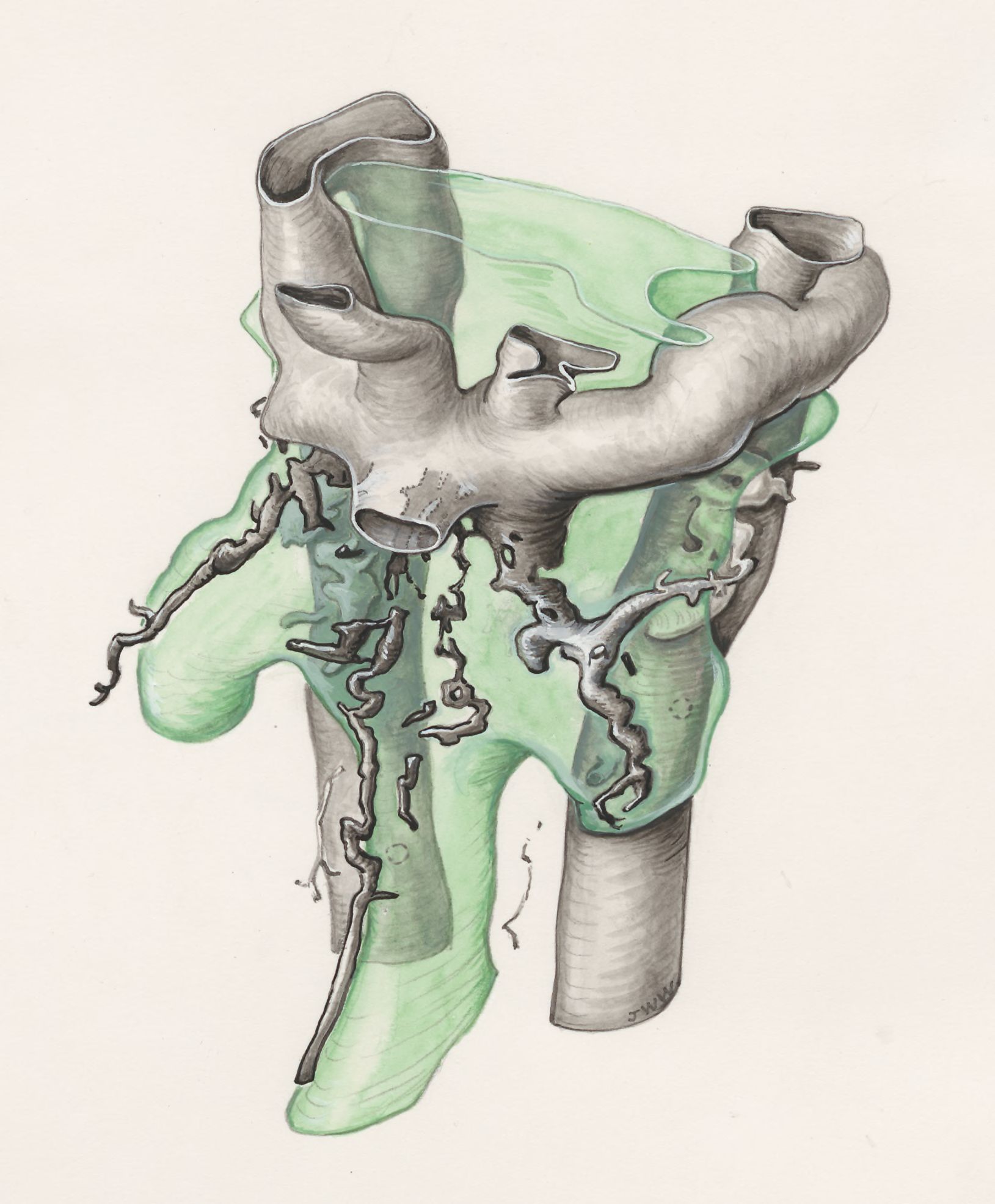 Human embryo