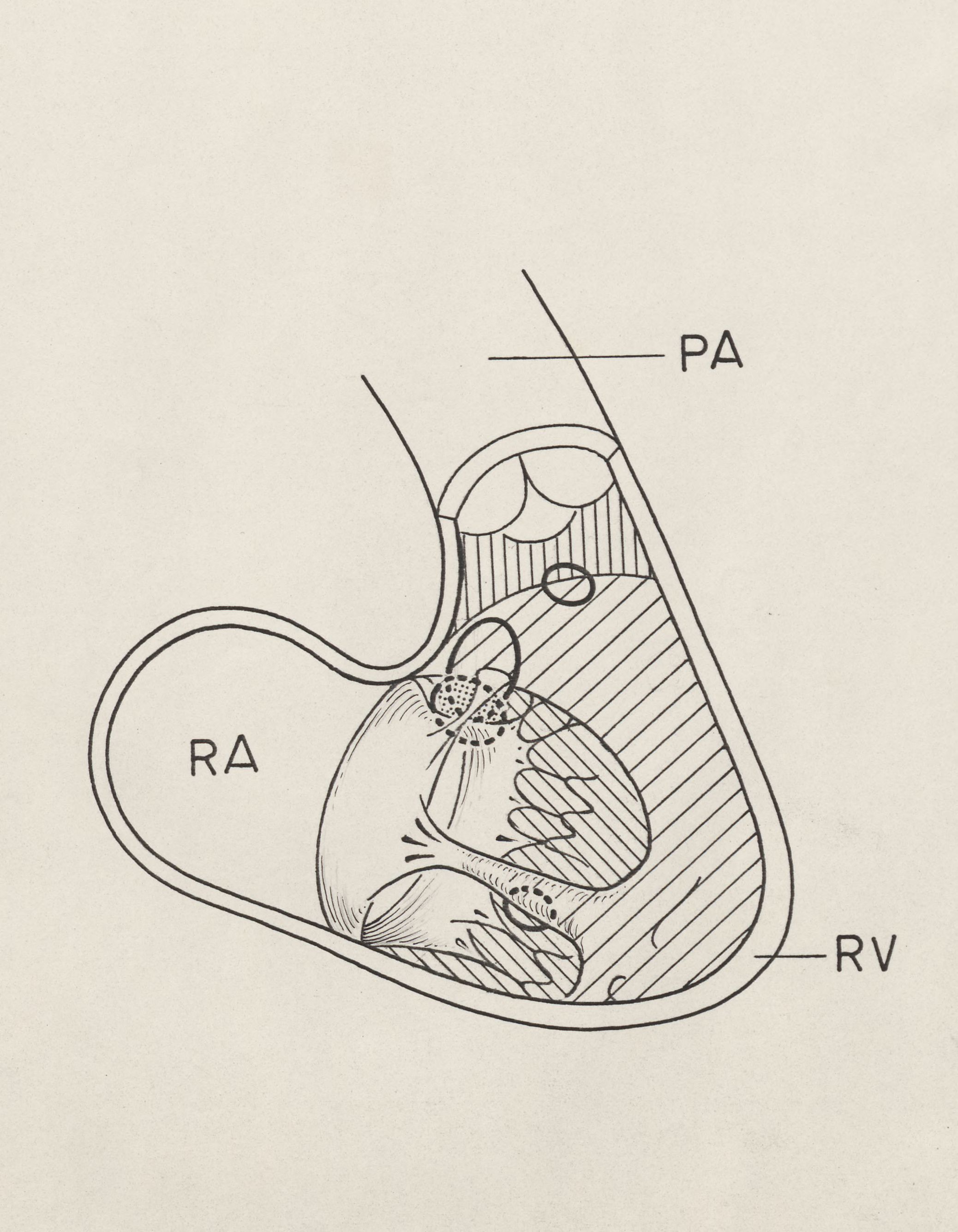 Cardiovascular system