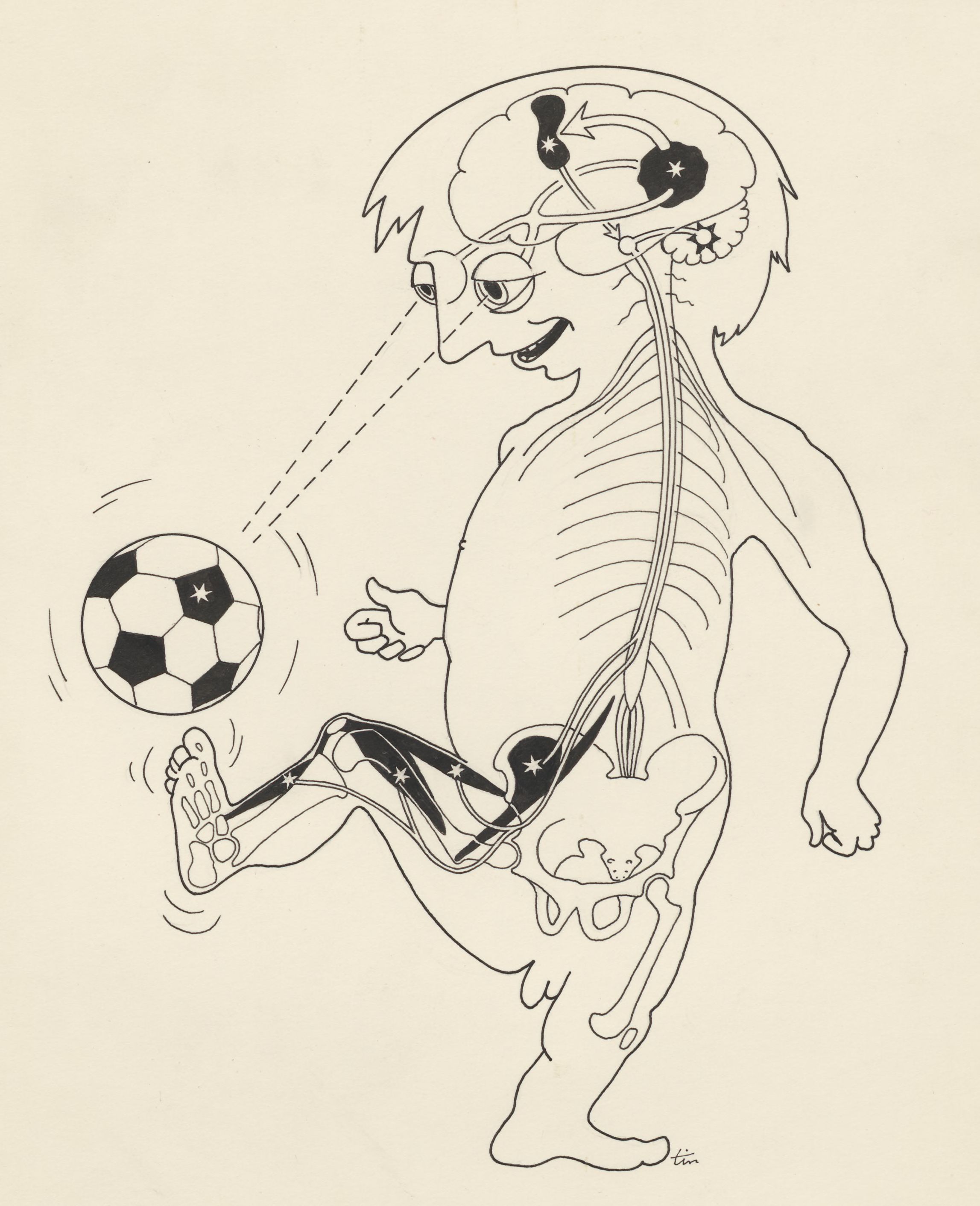 cartoon about the functioning of eye–hand coordination