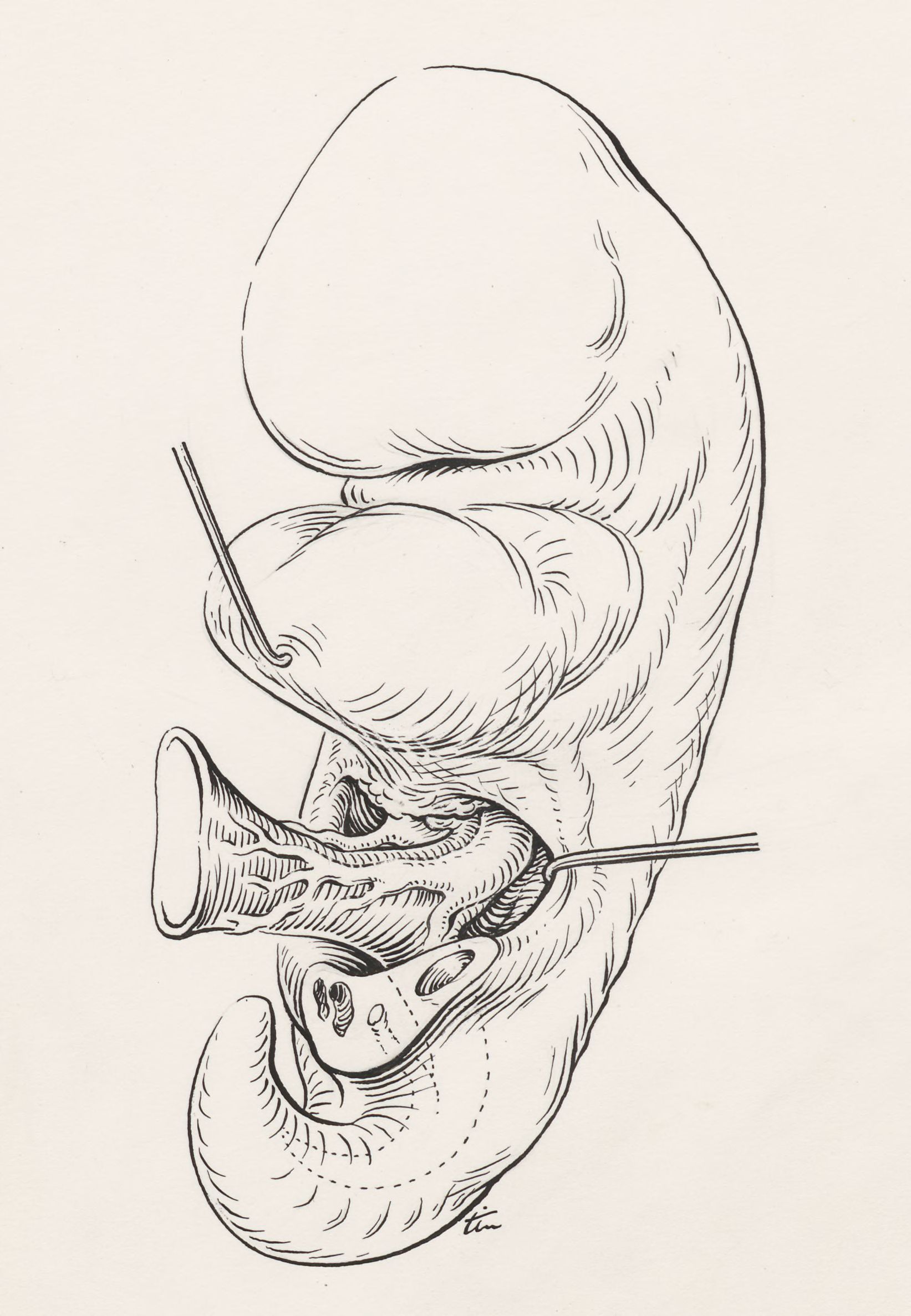 Human embryo