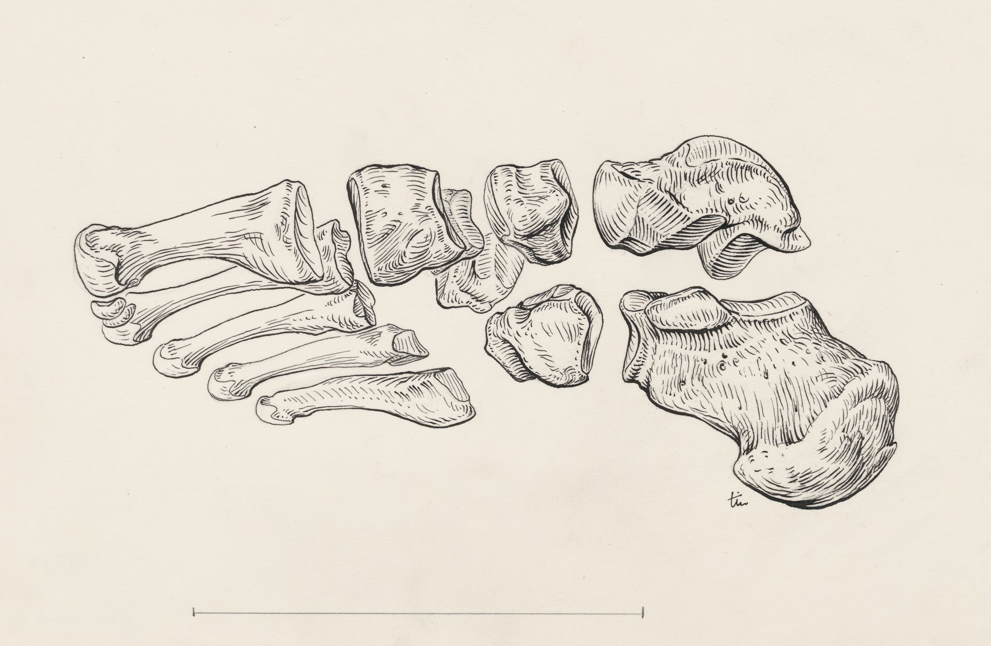 Eleven bones of the foot