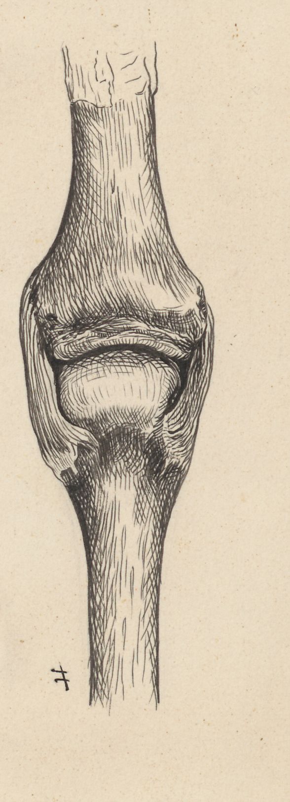 Joints of the hand or fingers