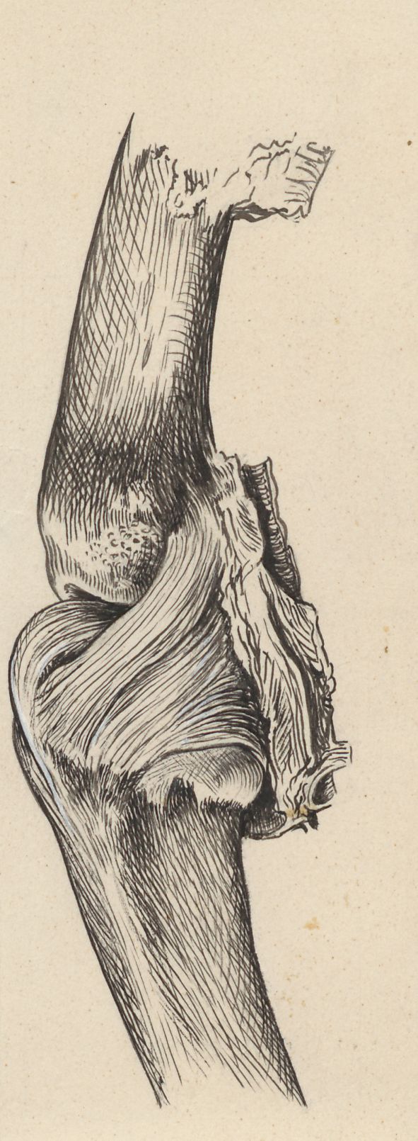 Joints of the hand or fingers