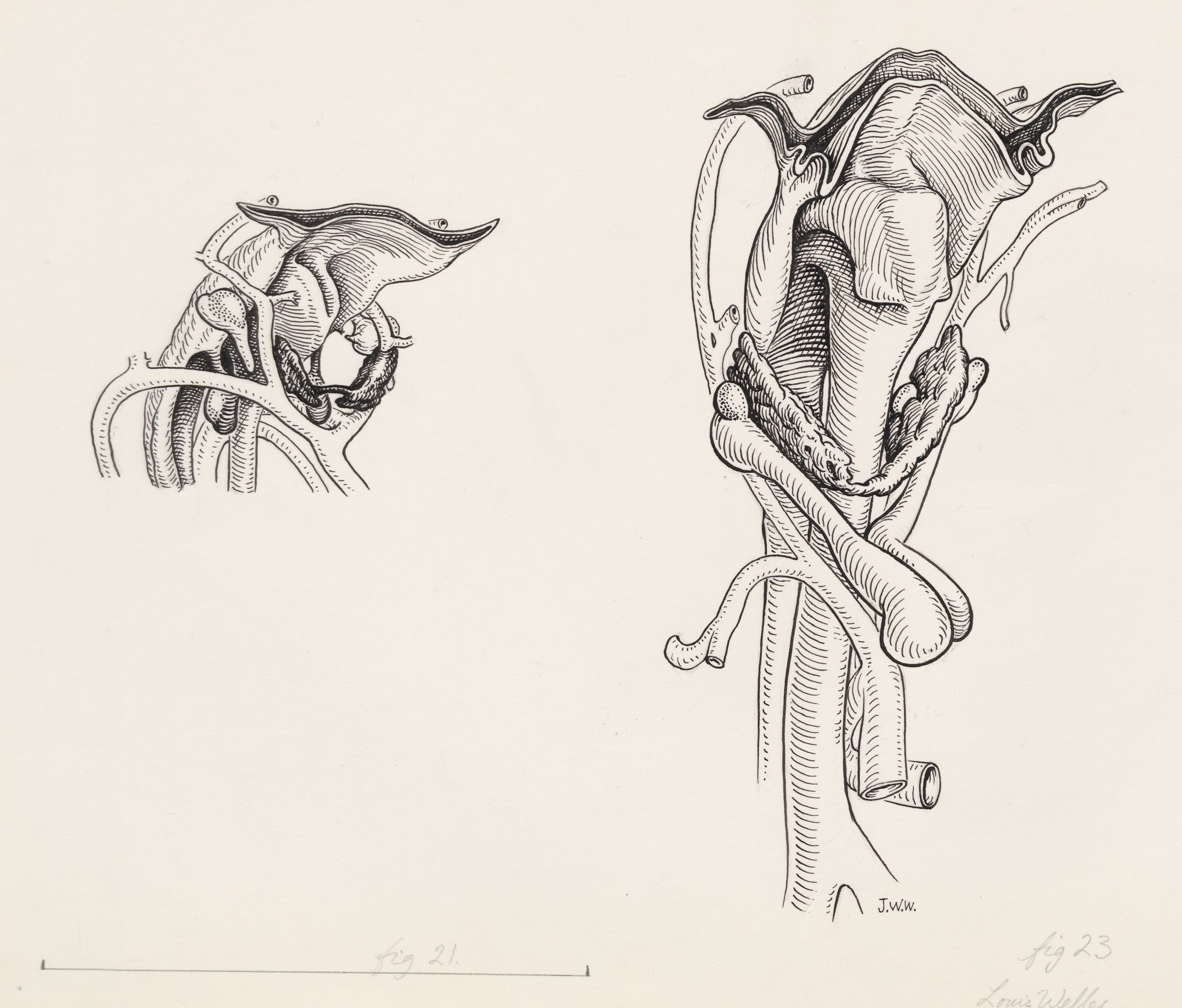 Tissue of the human throat, seen from two sides
