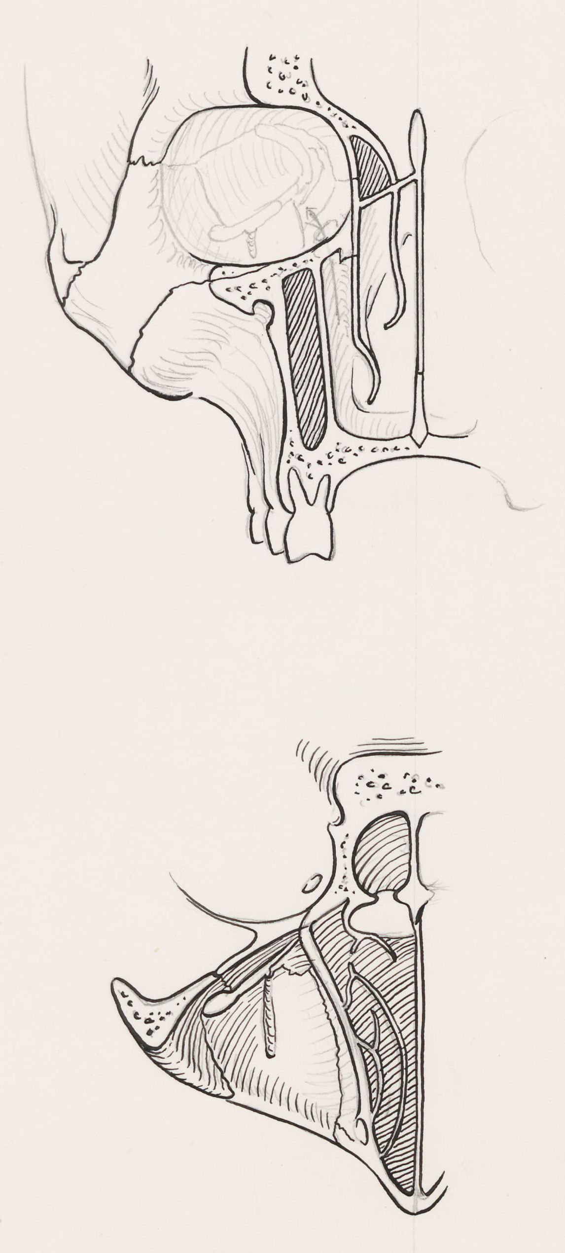 Cross section of the palate and/or nasal cavity of a human and a mammal
