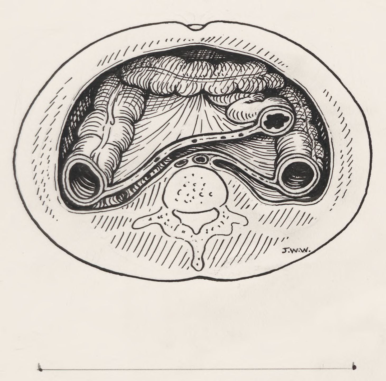 Tissue relating to the throat