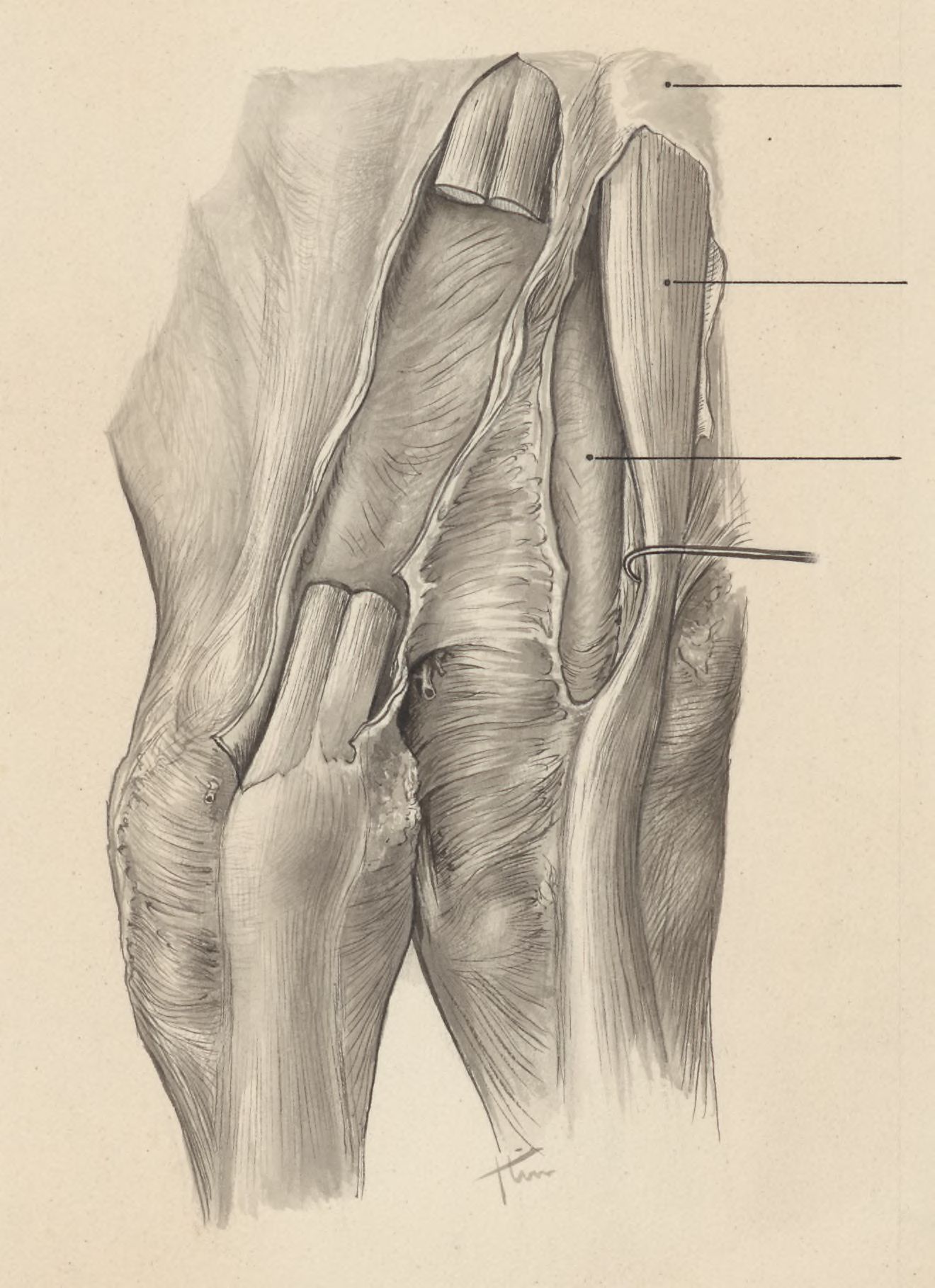 Musculoskeletal system of the upper extremity