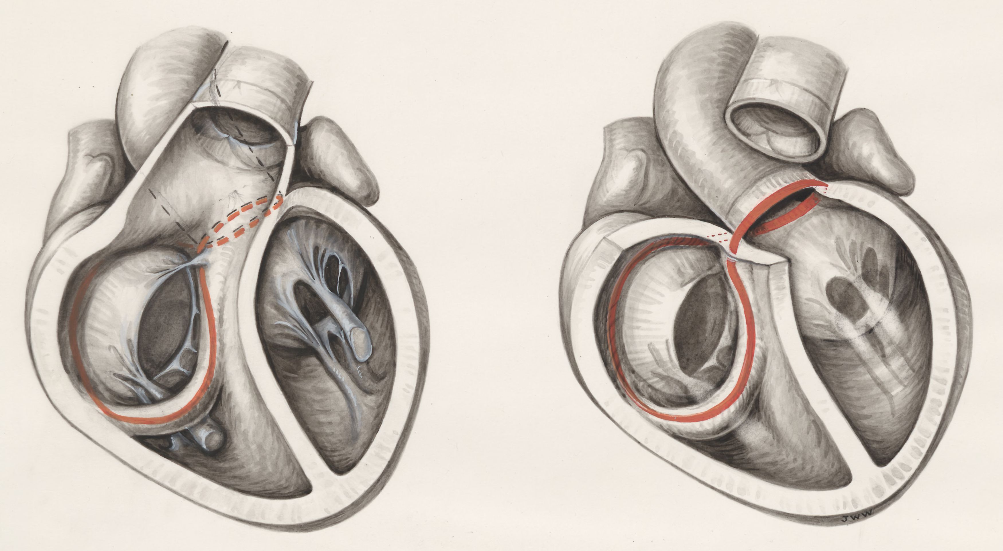 Two cross sections of the human heart