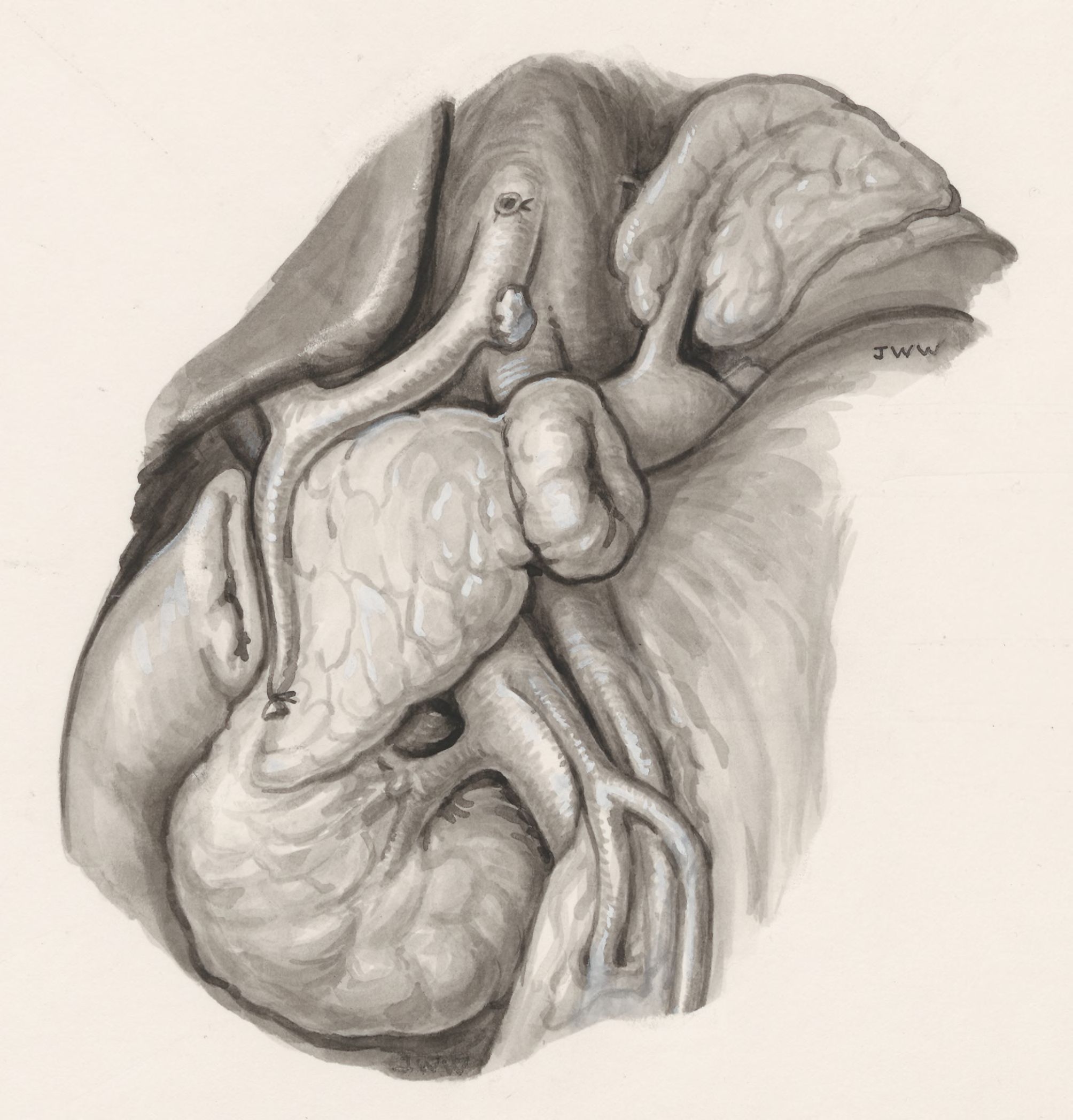 Human tissue