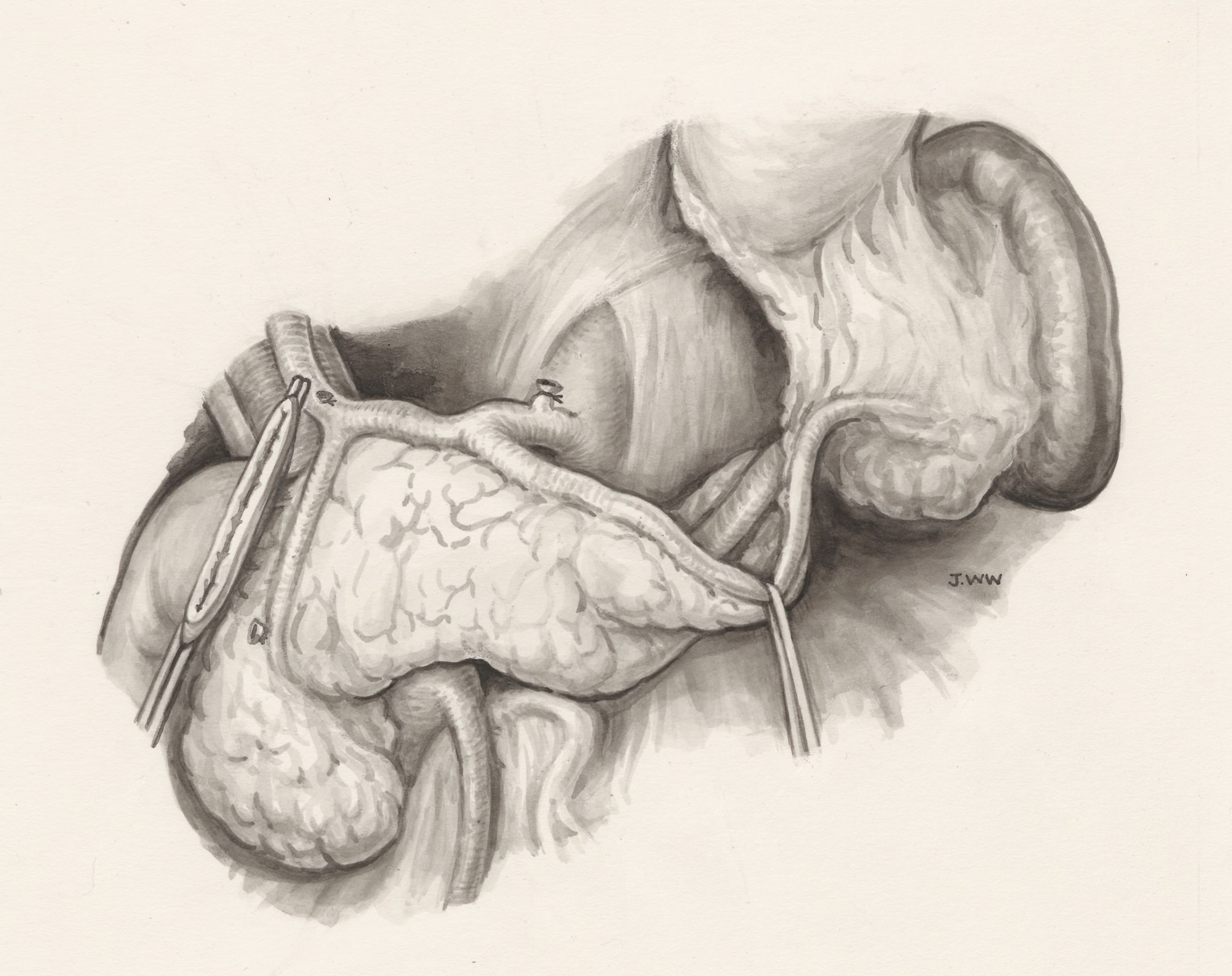 Operation on human tissue
