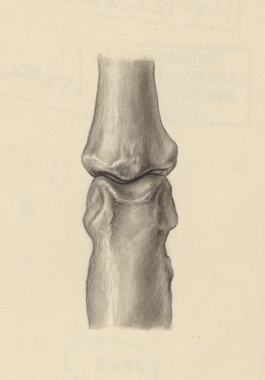 Joints of the hand or fingers