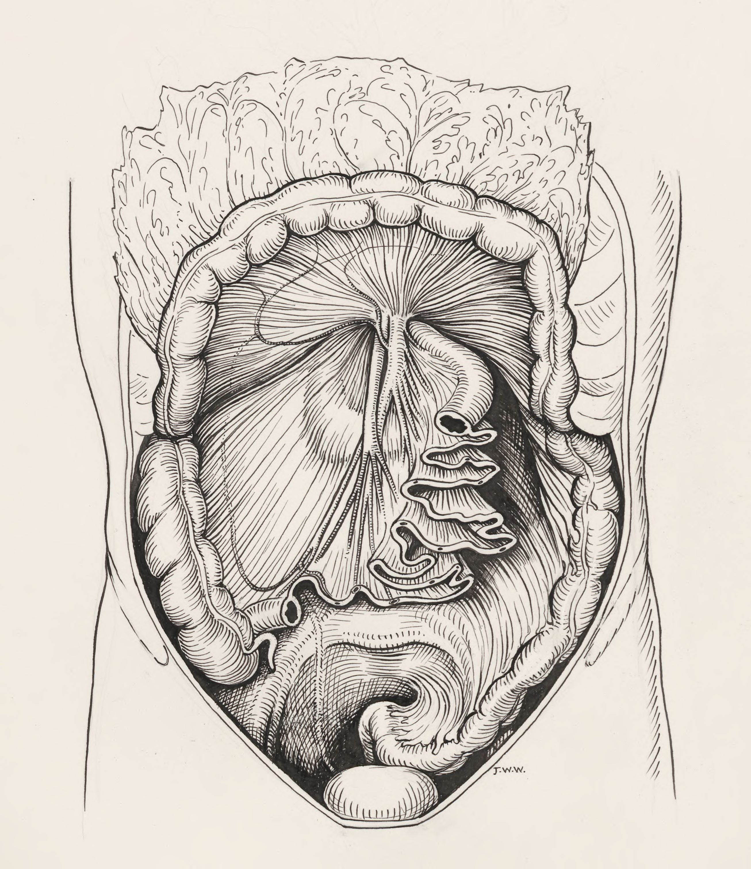 Intestinal tissue