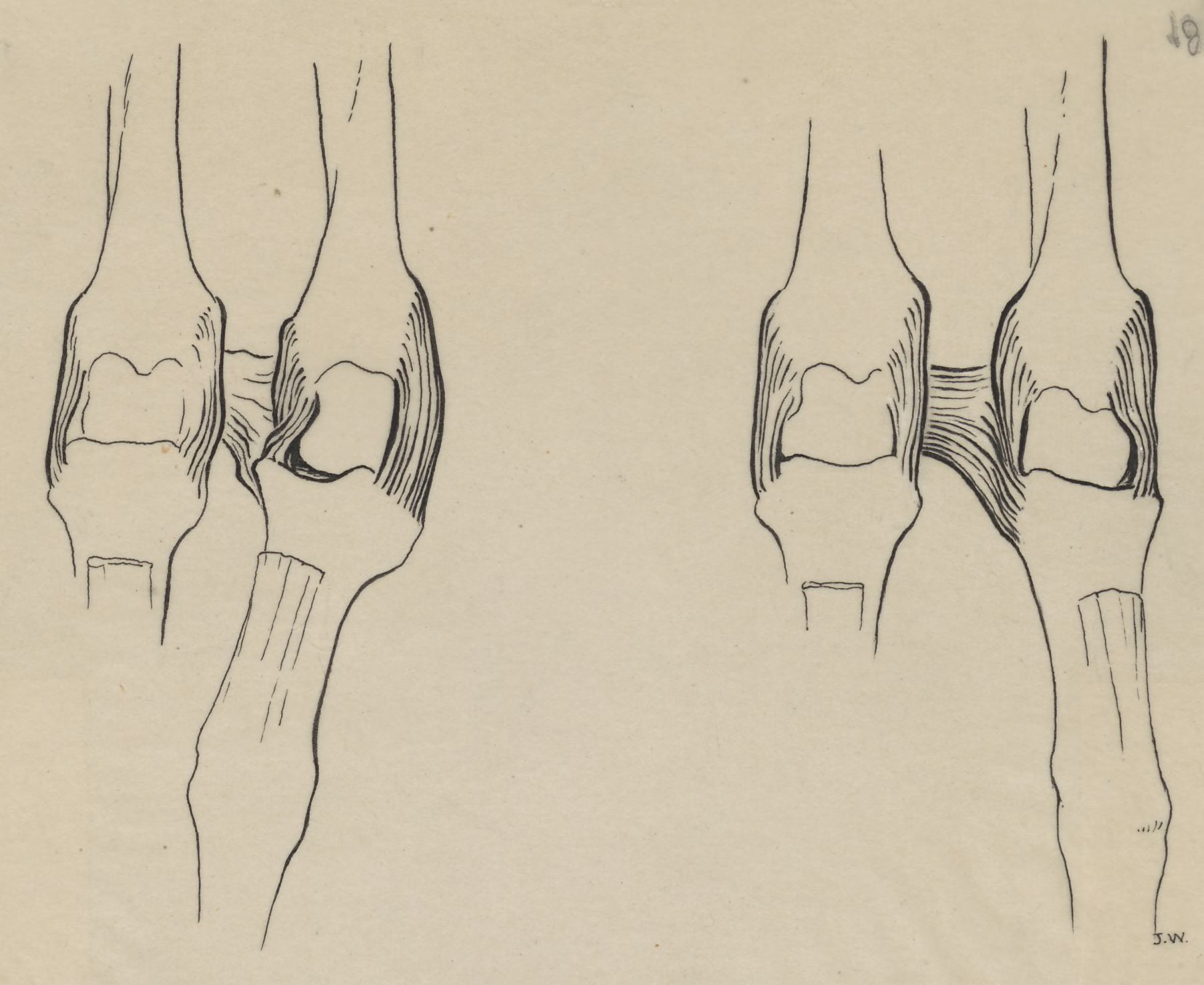 Two sets of finger joints