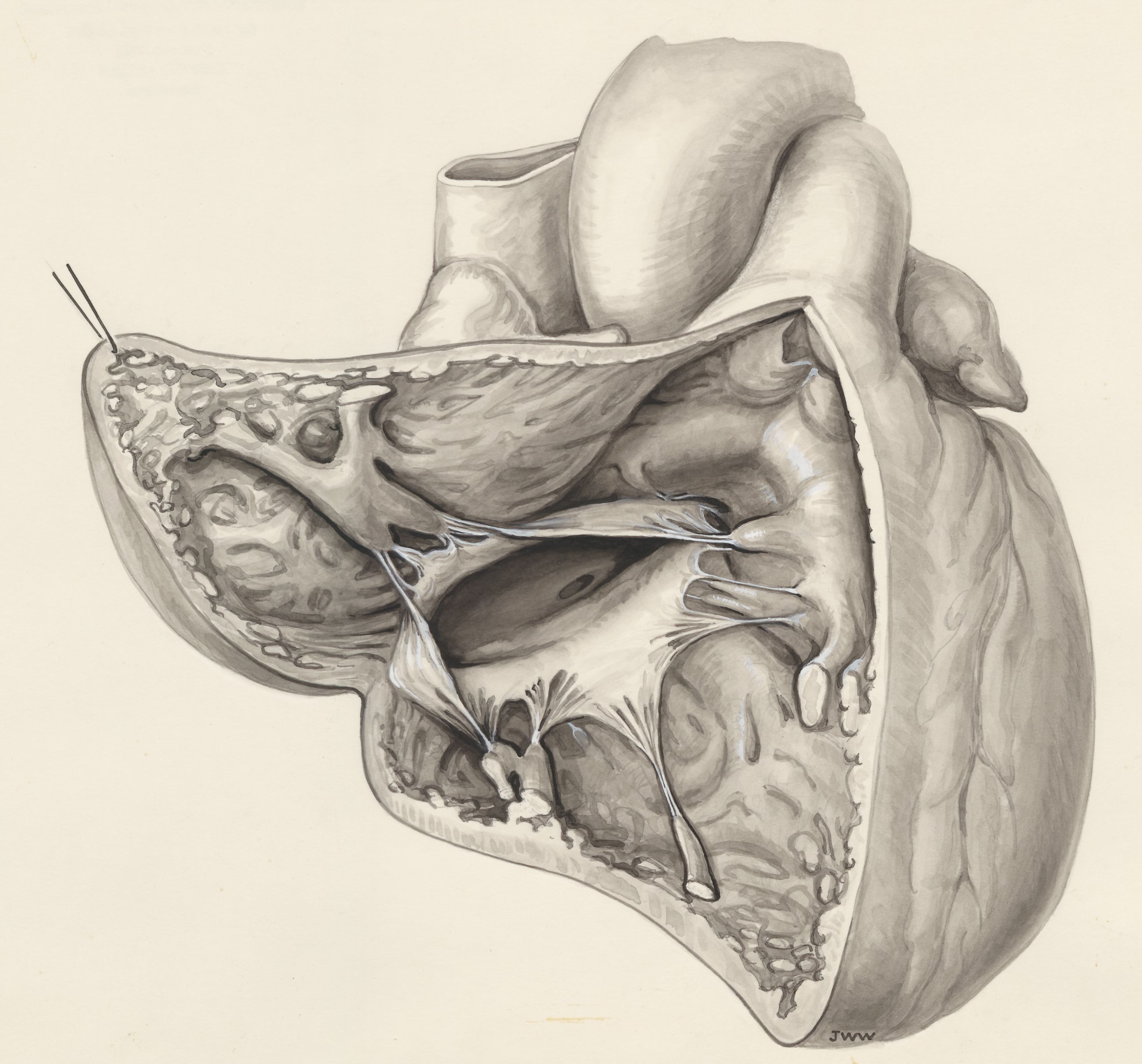 Heart