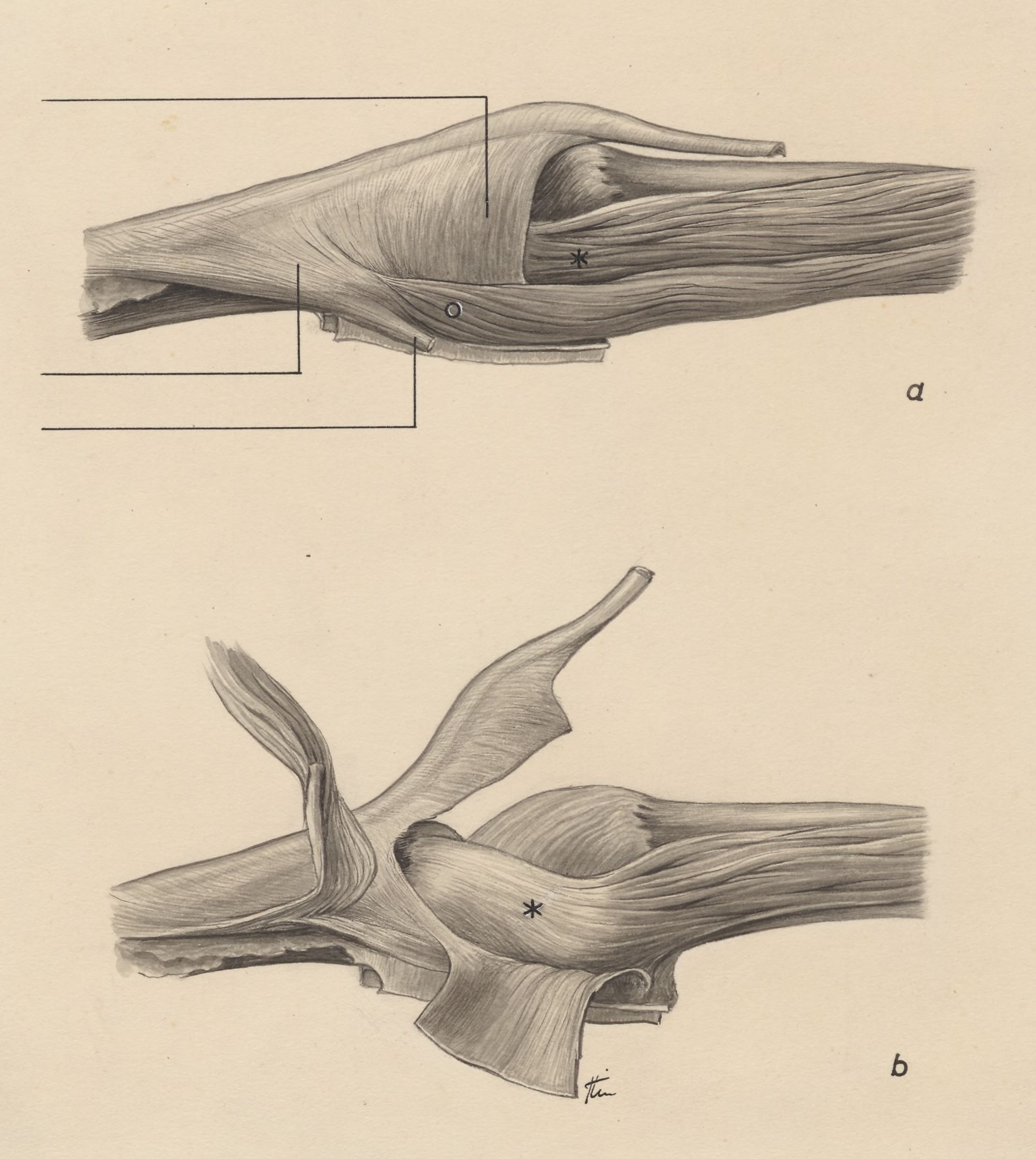 Muscular tissue of the finger