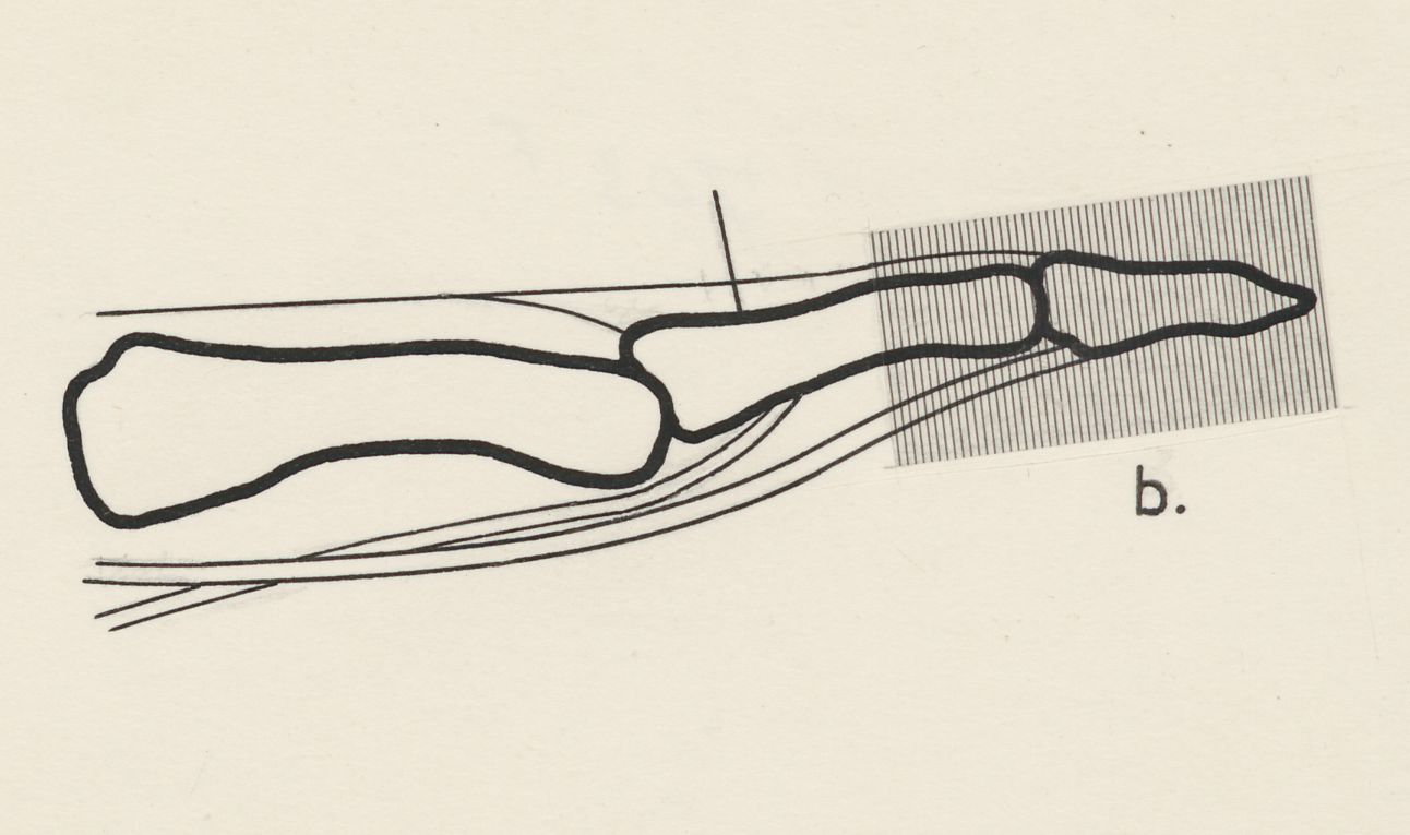 Schematic representation of the finger