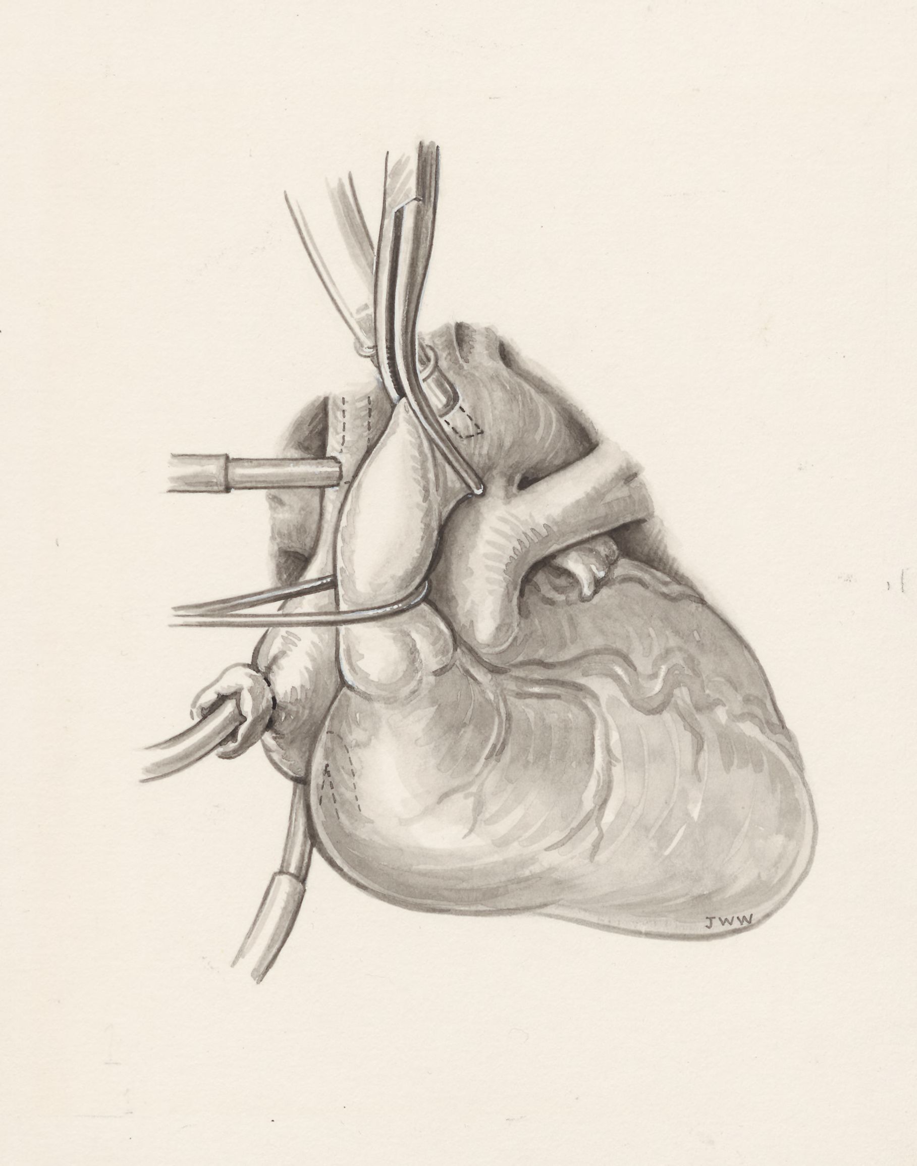 Cardiovascular system