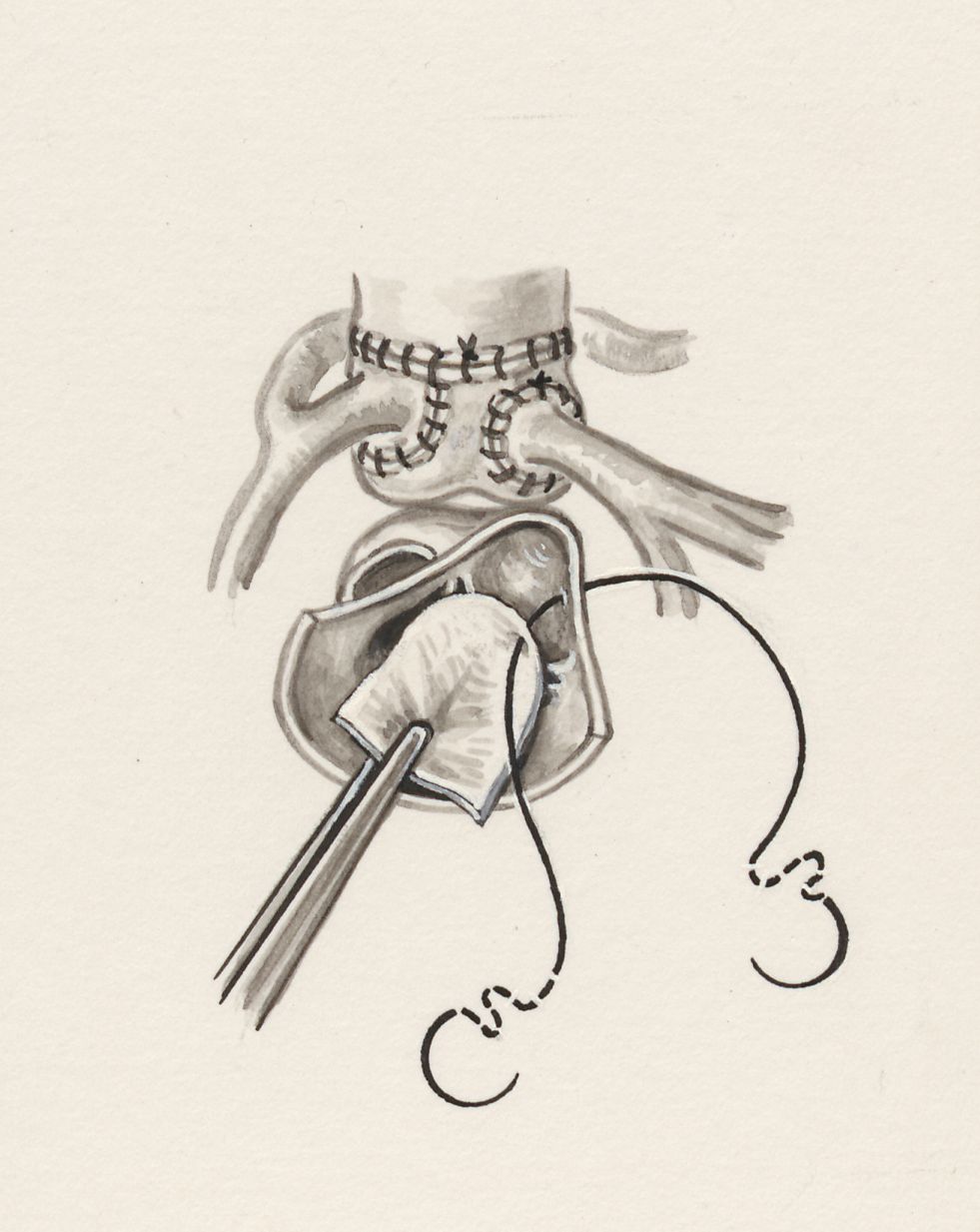 Cardiovascular system
