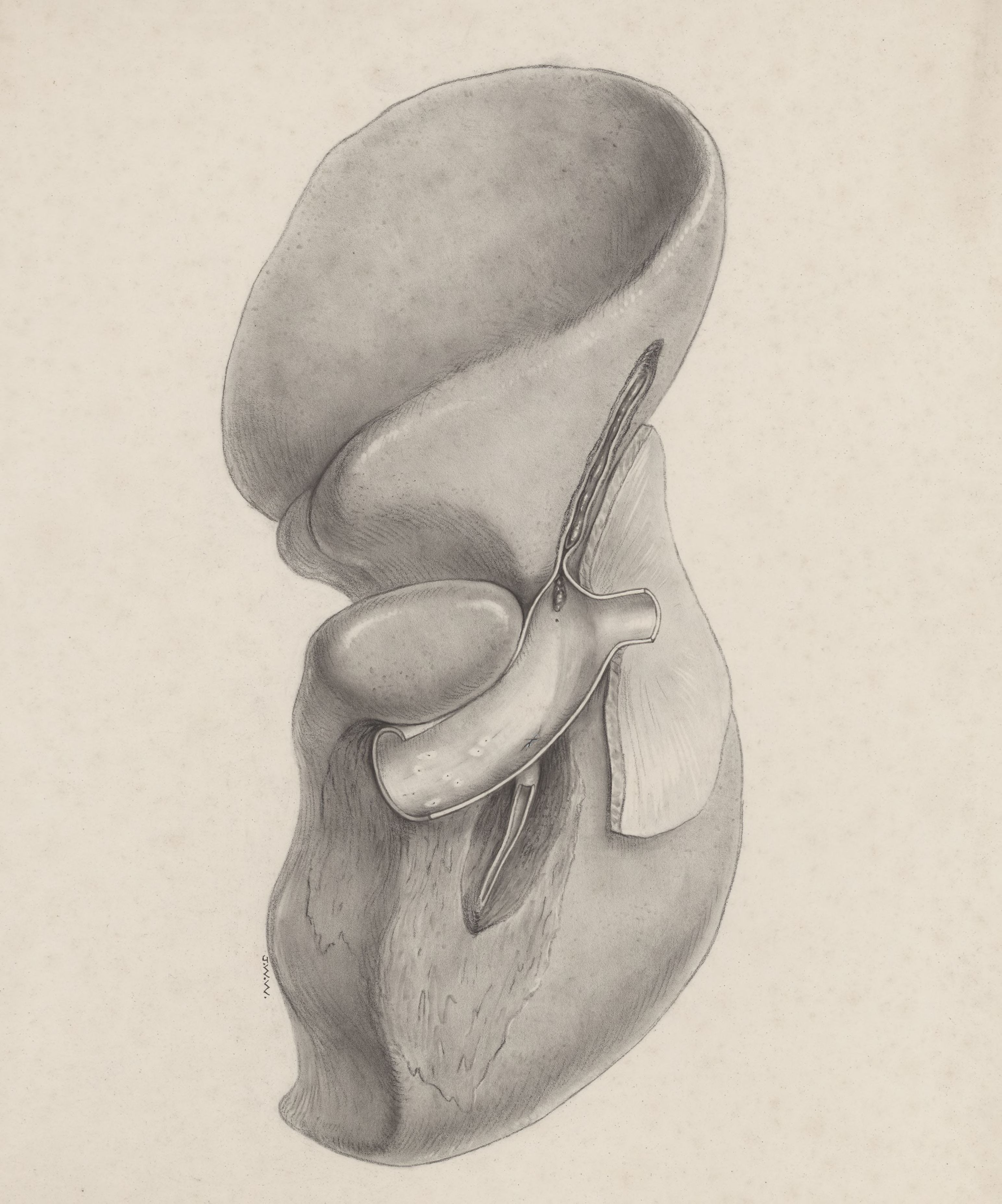 Human tissue